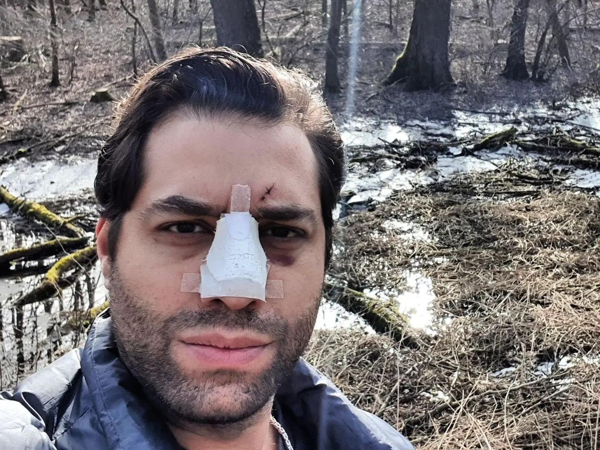 Der Kölner Schauspieler Kais Setti schaut mit einem Pflaster auf der Nase in die Kamera.