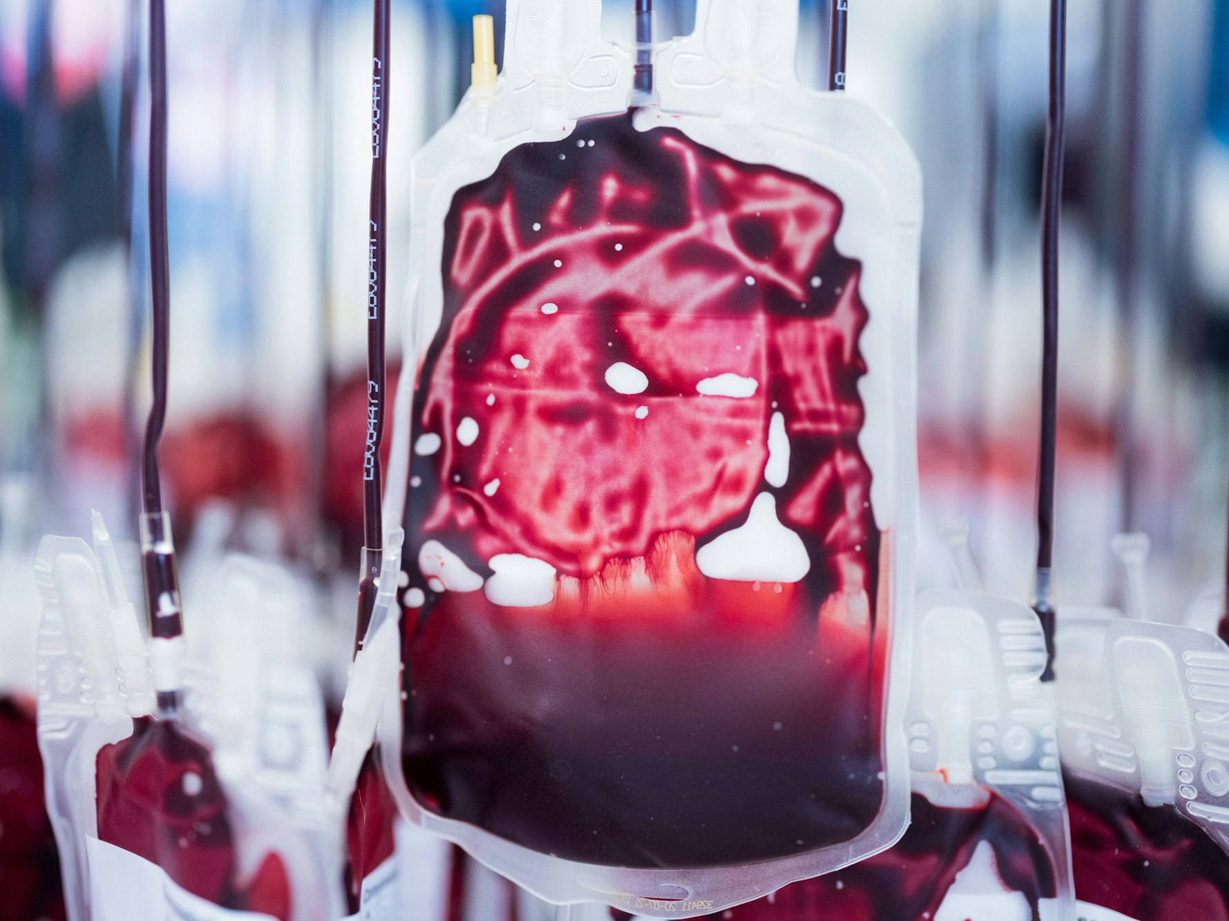 Mikroplastik wurde nun erstmals im menschlichen Blut (hier ein Symbolfoto) nachgewiesen.