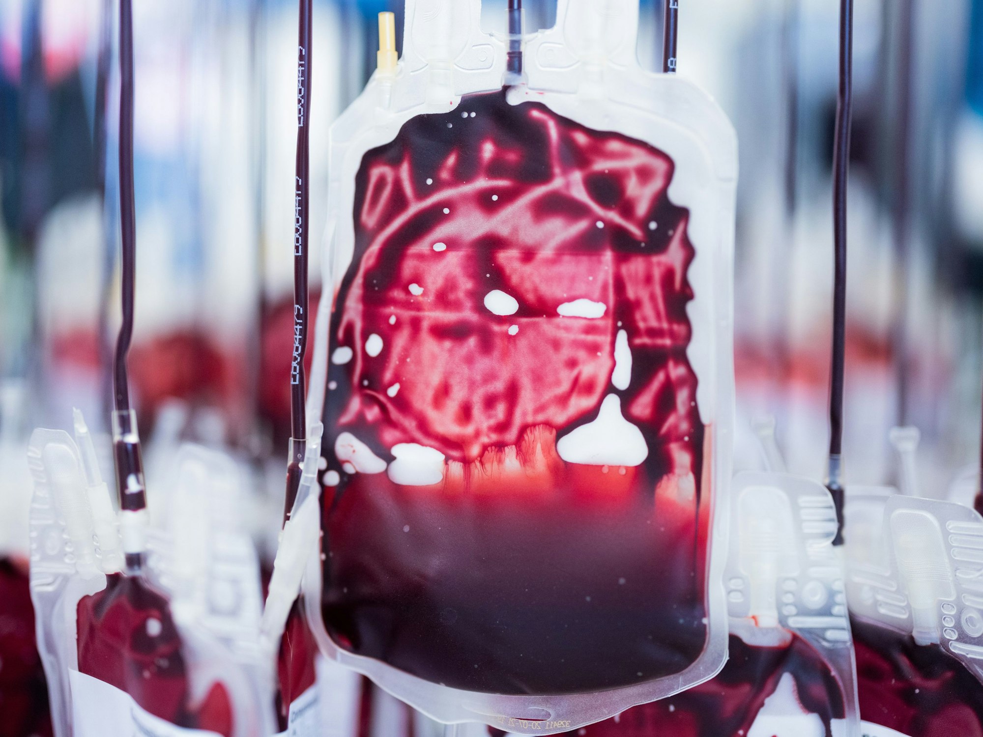 Mikroplastik wurde nun erstmals im menschlichen Blut (hier ein Symbolfoto) nachgewiesen.