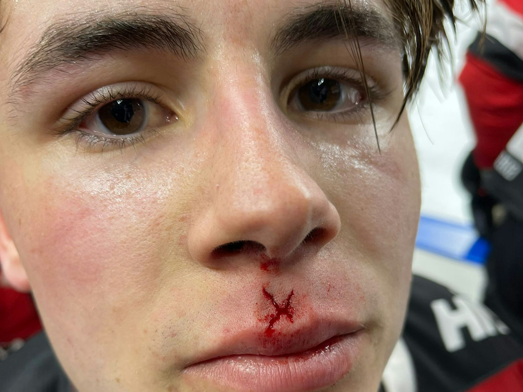 Luis Üffing, Stürmer der Kölner Haie, mit einem Cut nach dem DEL-Spiel gegen Ingolstadt.