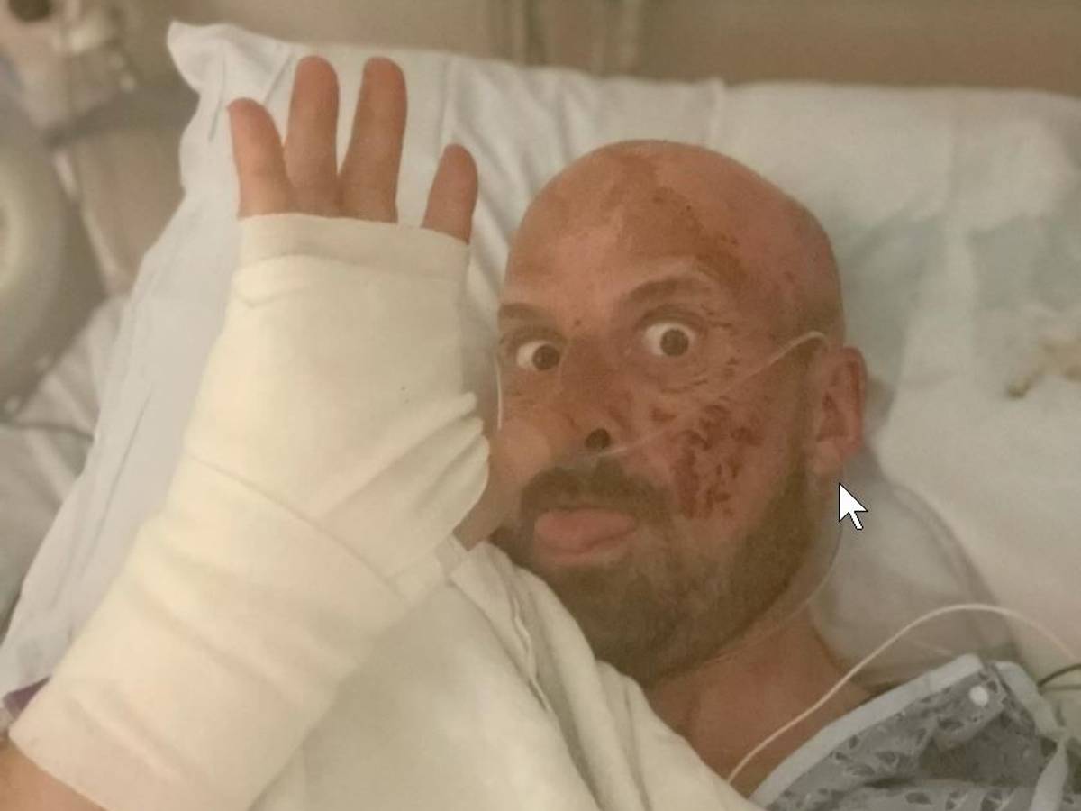Jonathan Goodwin winkt aus dem Krankenbett in die Kamera. Er ist von einem schlimmen Sturz gezeichnet.