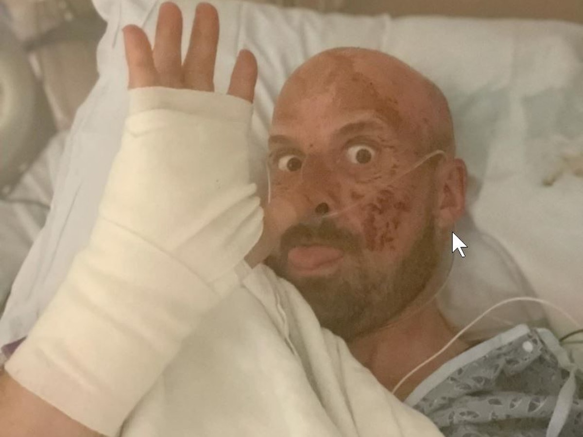 Jonathan Goodwin winkt aus dem Krankenbett in die Kamera. Er ist von einem schlimmen Sturz gezeichnet.