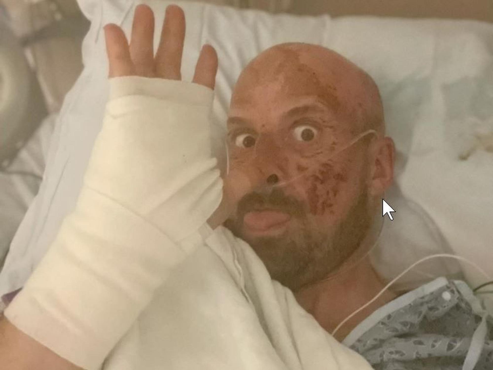 Jonathan Goodwin winkt aus dem Krankenbett in die Kamera. Er ist von einem schlimmen Sturz gezeichnet.