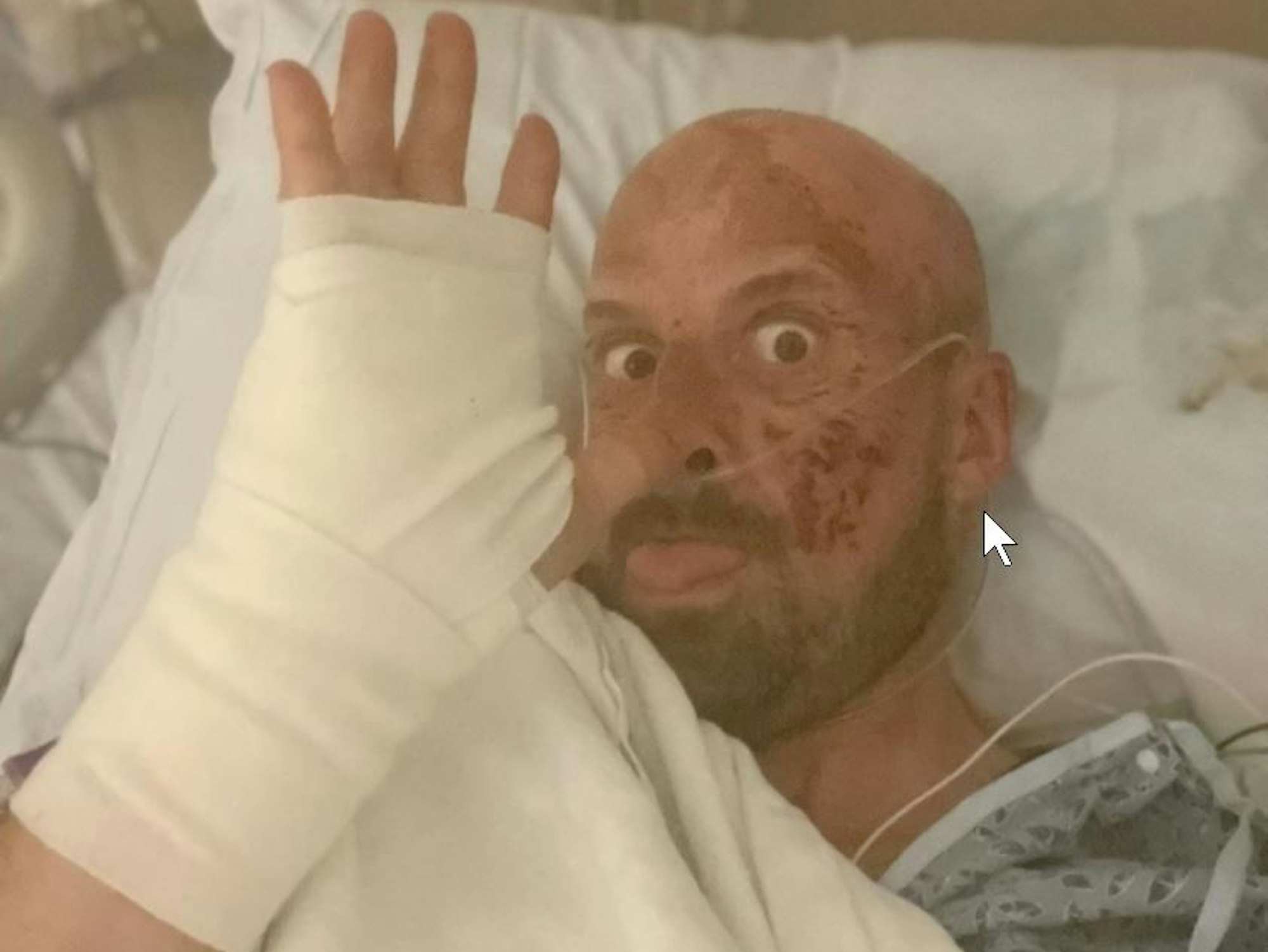 Jonathan Goodwin winkt aus dem Krankenbett in die Kamera. Er ist von einem schlimmen Sturz gezeichnet.