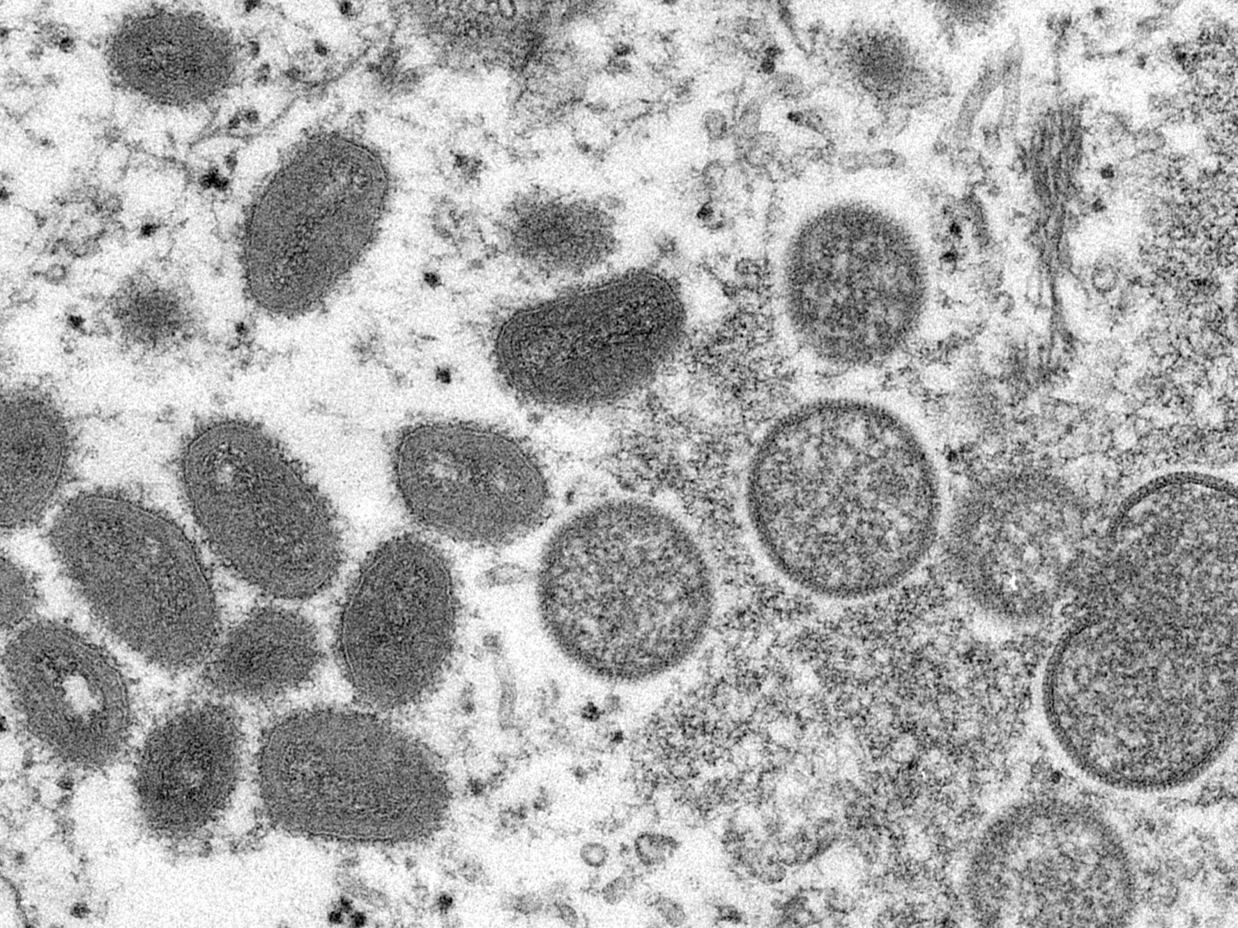 Diese elektronenmikroskopische Aufnahme aus dem Jahr 2003, die von den Centers for Disease Control and Prevention zur Verfügung gestellt wurde, zeigt reife, ovale Affenpockenviren (l) und kugelförmige unreife Virionen (r).