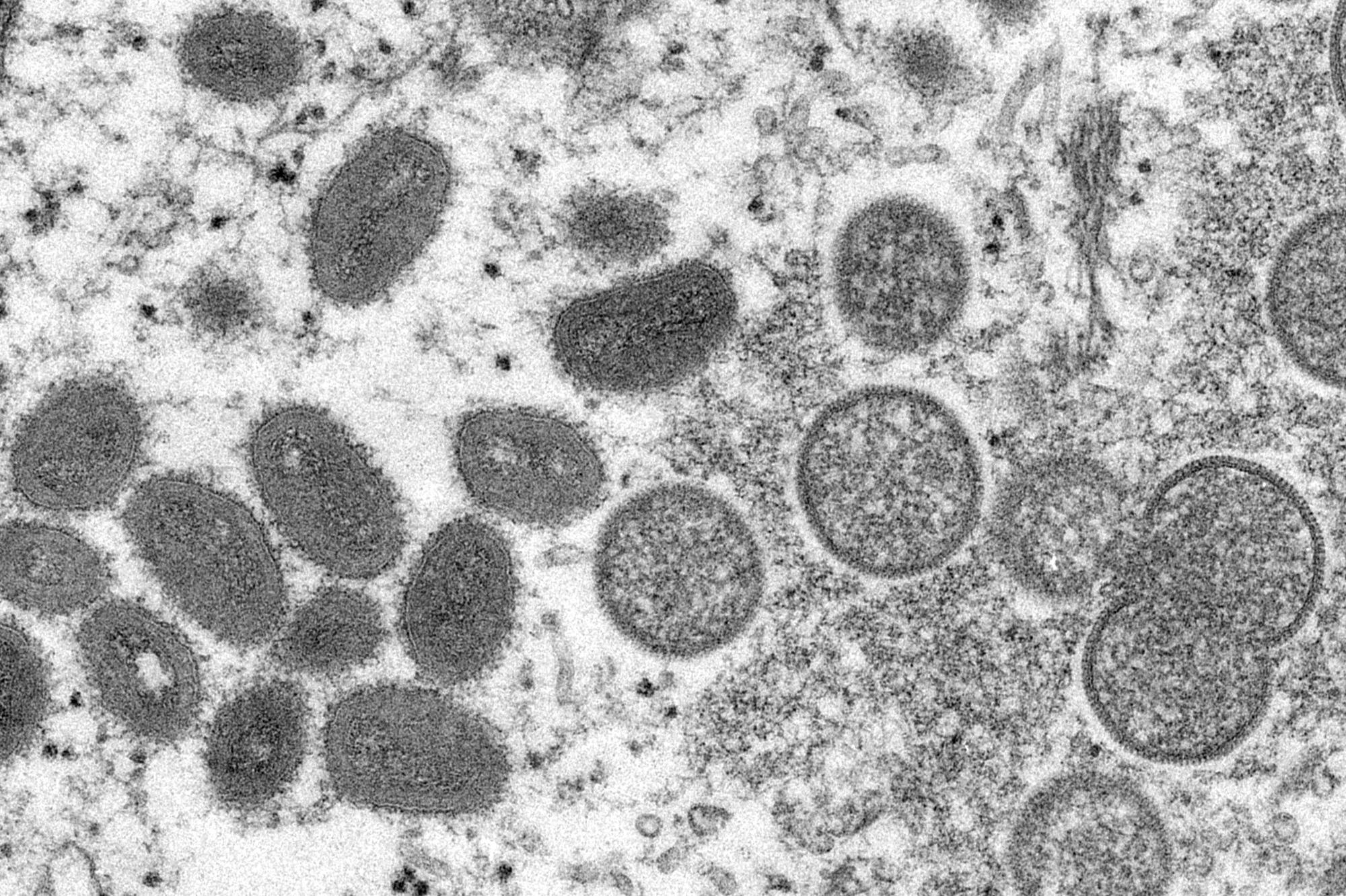 Diese elektronenmikroskopische Aufnahme aus dem Jahr 2003, die von den Centers for Disease Control and Prevention zur Verfügung gestellt wurde, zeigt reife, ovale Affenpockenviren (l) und kugelförmige unreife Virionen (r), die aus einer menschlichen Hautprobe im Zusammenhang mit dem Präriehundeausbruch von 2003 stammt.
