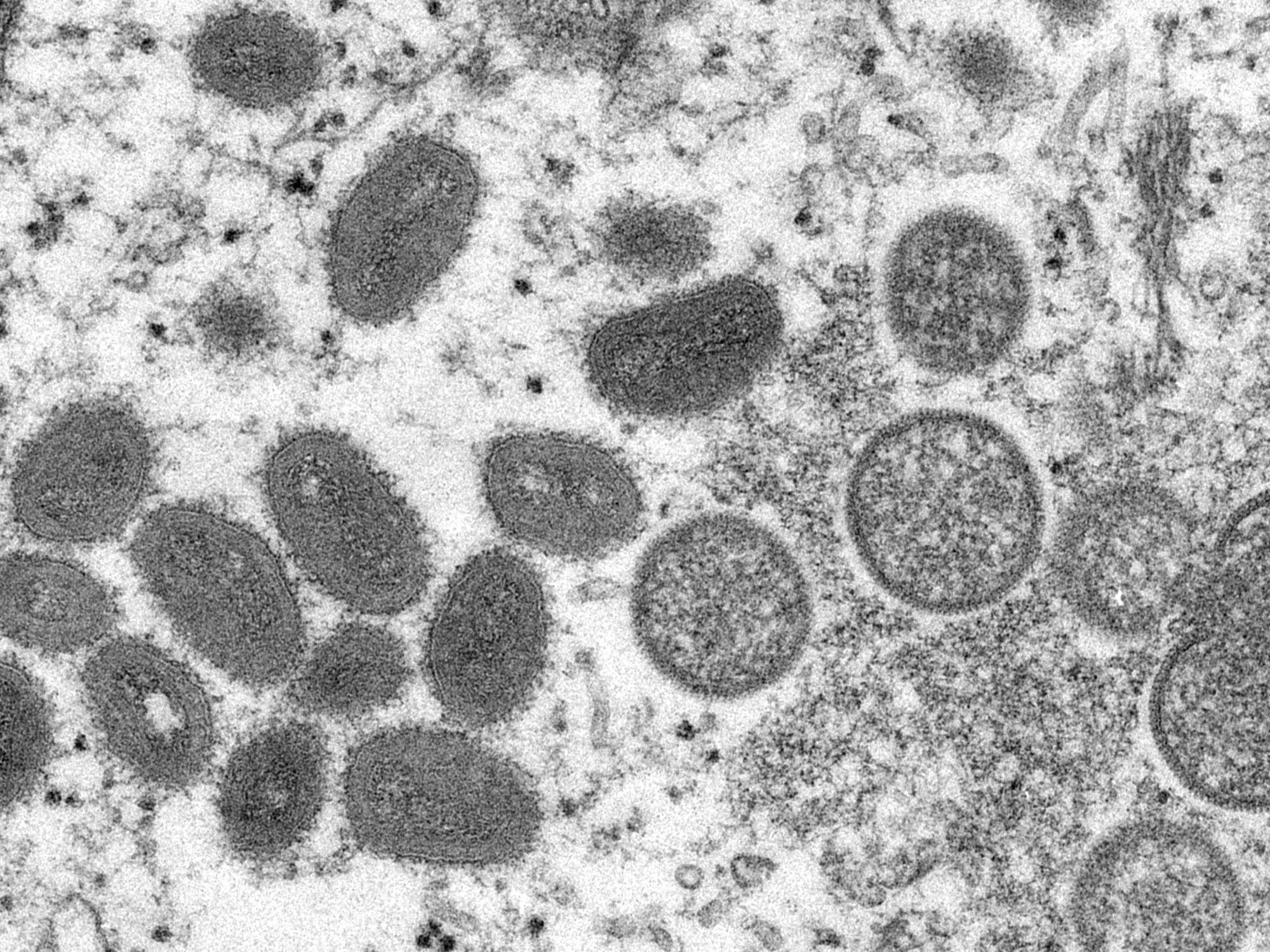 Diese elektronenmikroskopische Aufnahme aus dem Jahr 2003 zeigt reife, ovale Affenpockenviren (l) und kugelförmige unreife Virionen (r), die aus einer menschlichen Hautprobe im Zusammenhang mit dem Präriehundeausbruch von 2003 stammt.