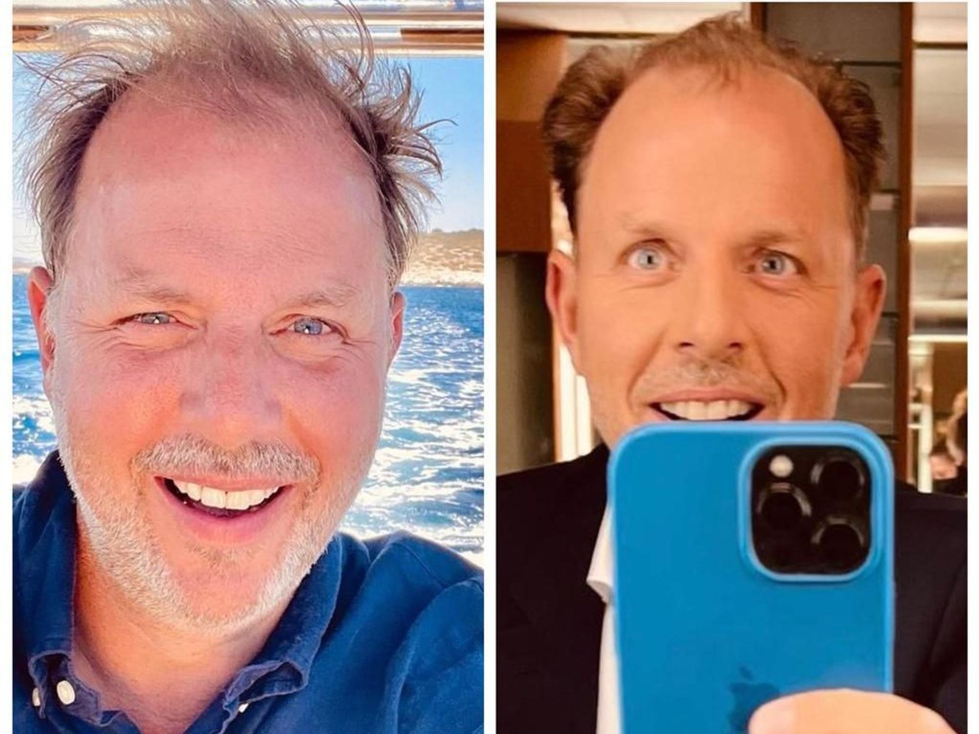 Vorher-Nachher-Bild zur Gewichtsveränderung von Anwalt Christian Solmecke.
