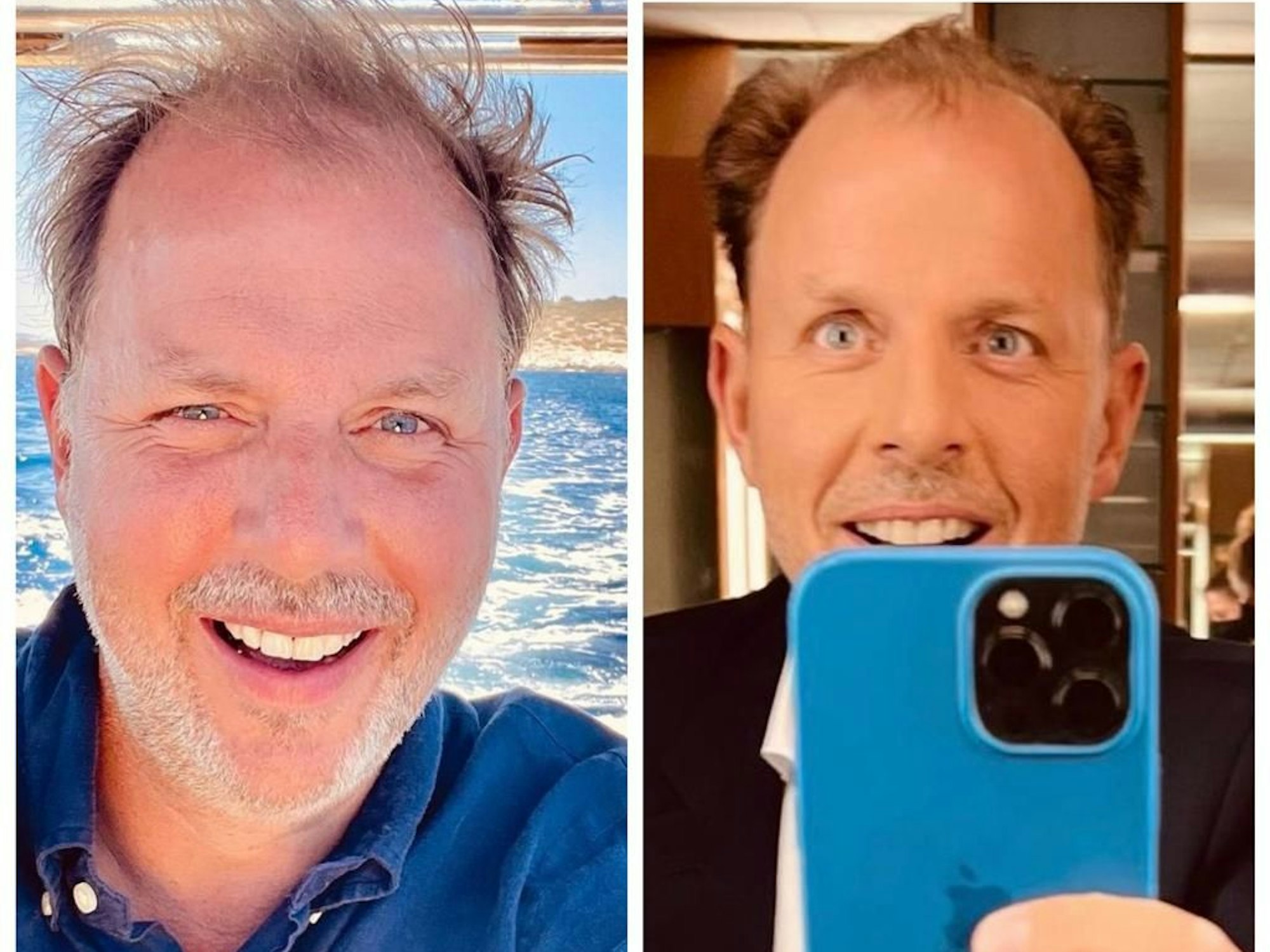 Vorher-Nachher-Bild zur Gewichtsveränderung von Anwalt Christian Solmecke.