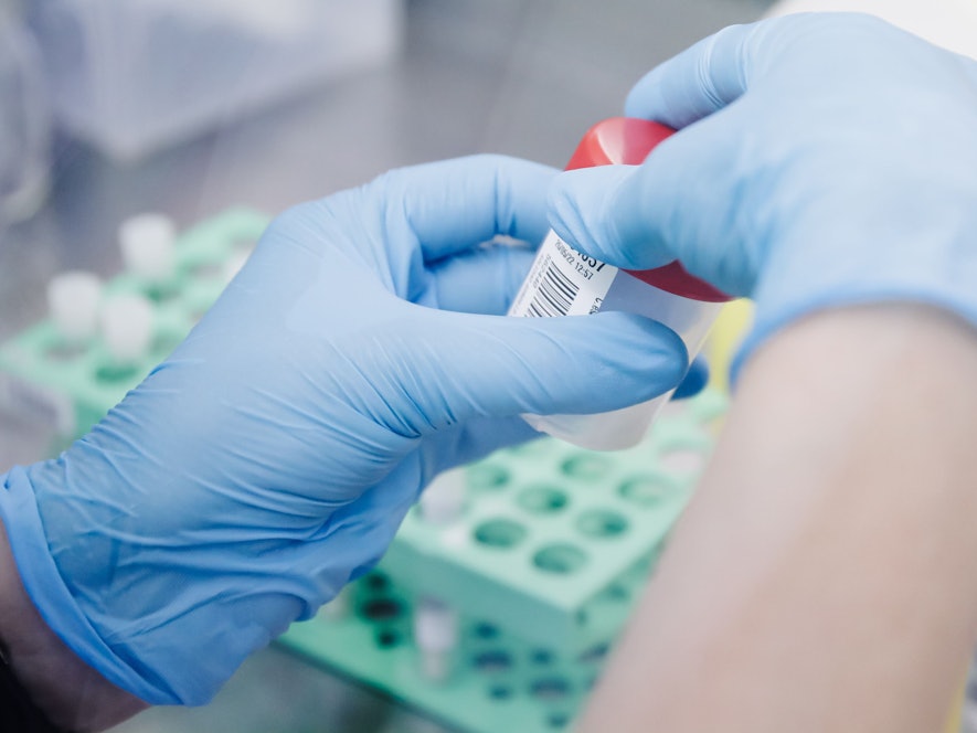 Affenpocken: Der Erreger breitet sich in Europa aus. Unser Foto zeigt einen Affenpockentest im Labor 2022.