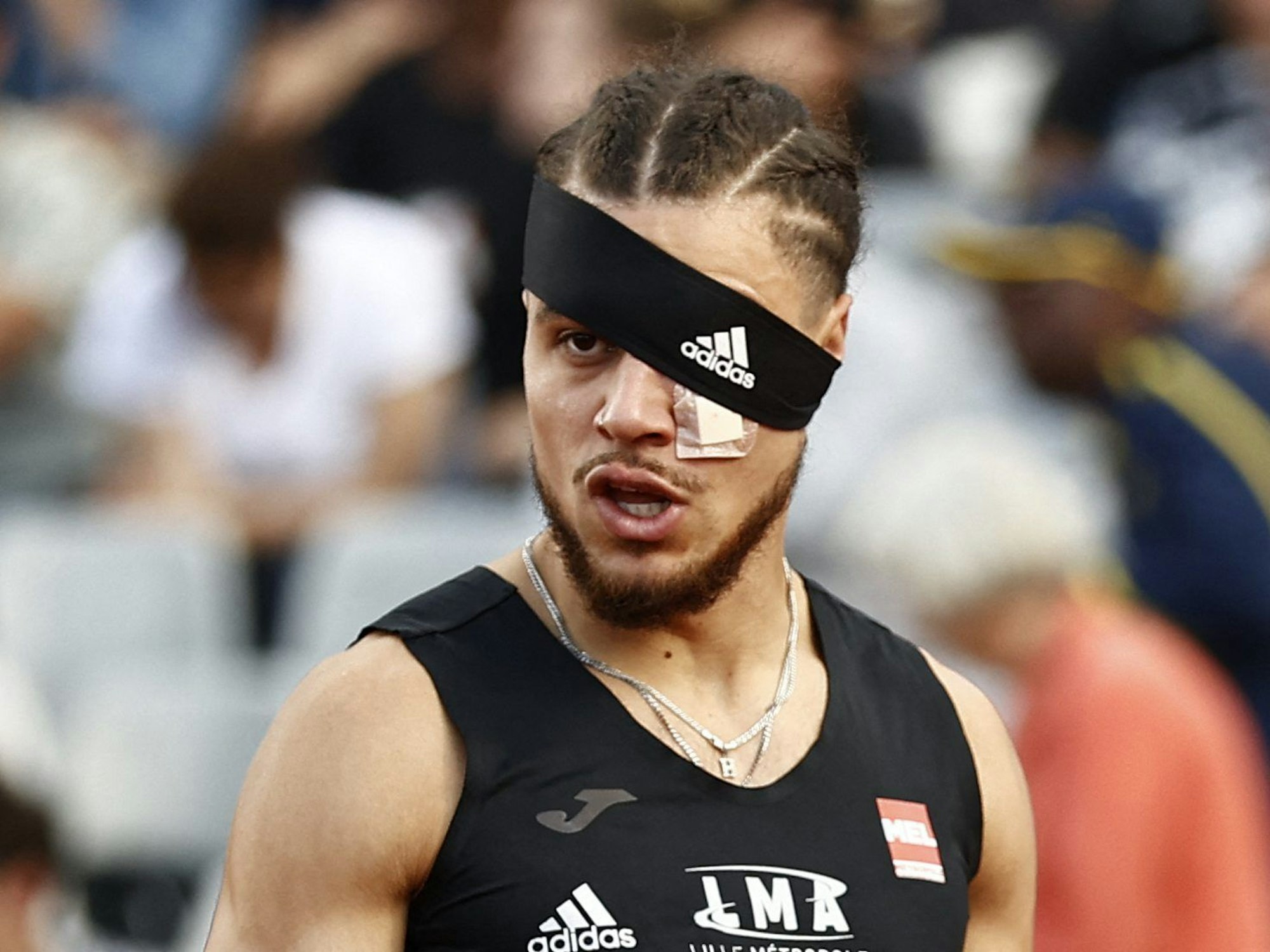 Wilfried Happio mit Pflaster und Stirnband über dem Auge.