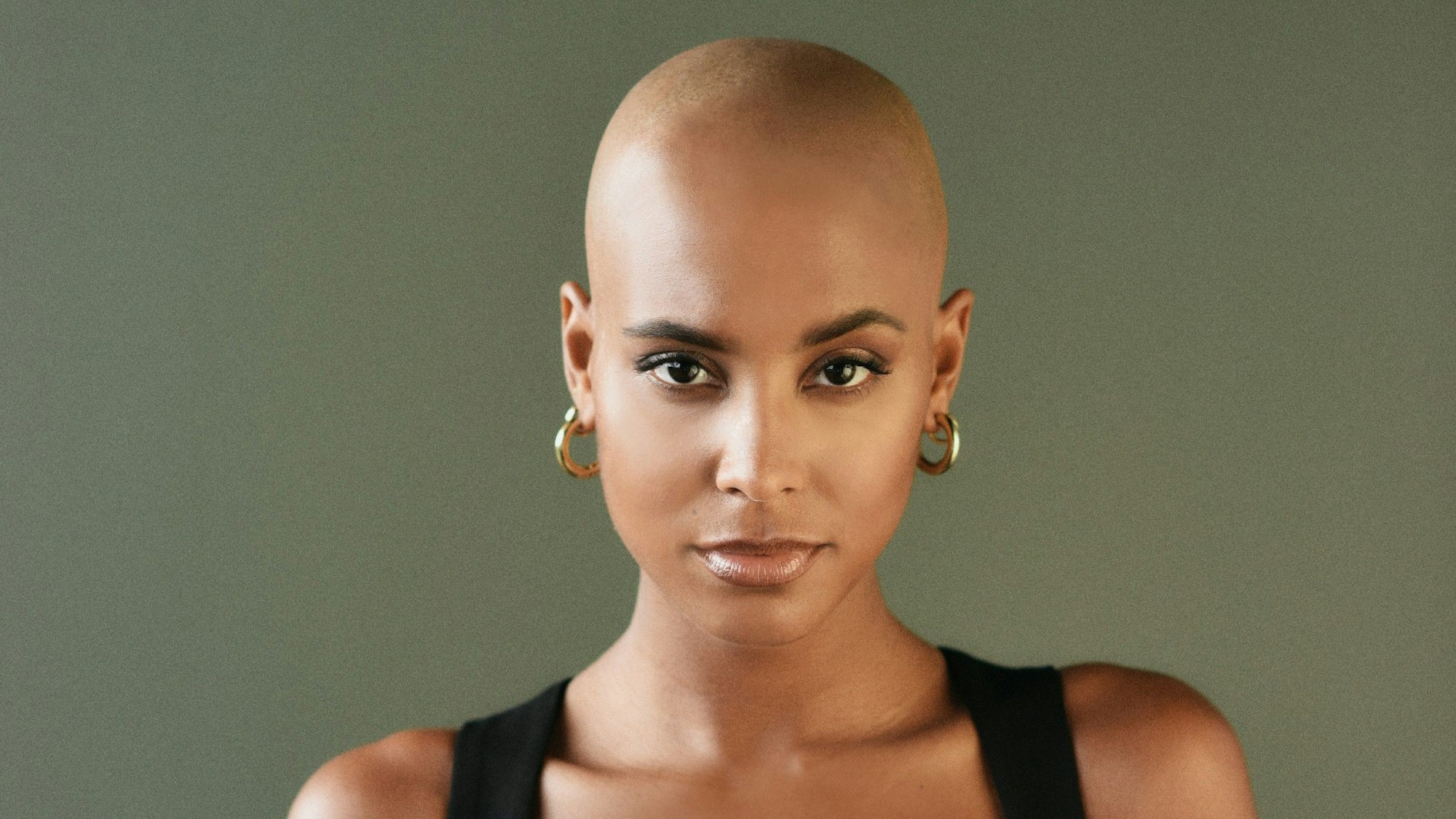 Sharon Battiste: Die RTL-Bachelorette leidet an kreisrundem Haarausfall. Vor der Show hat sie sich eine Glatz rasieren lassen.