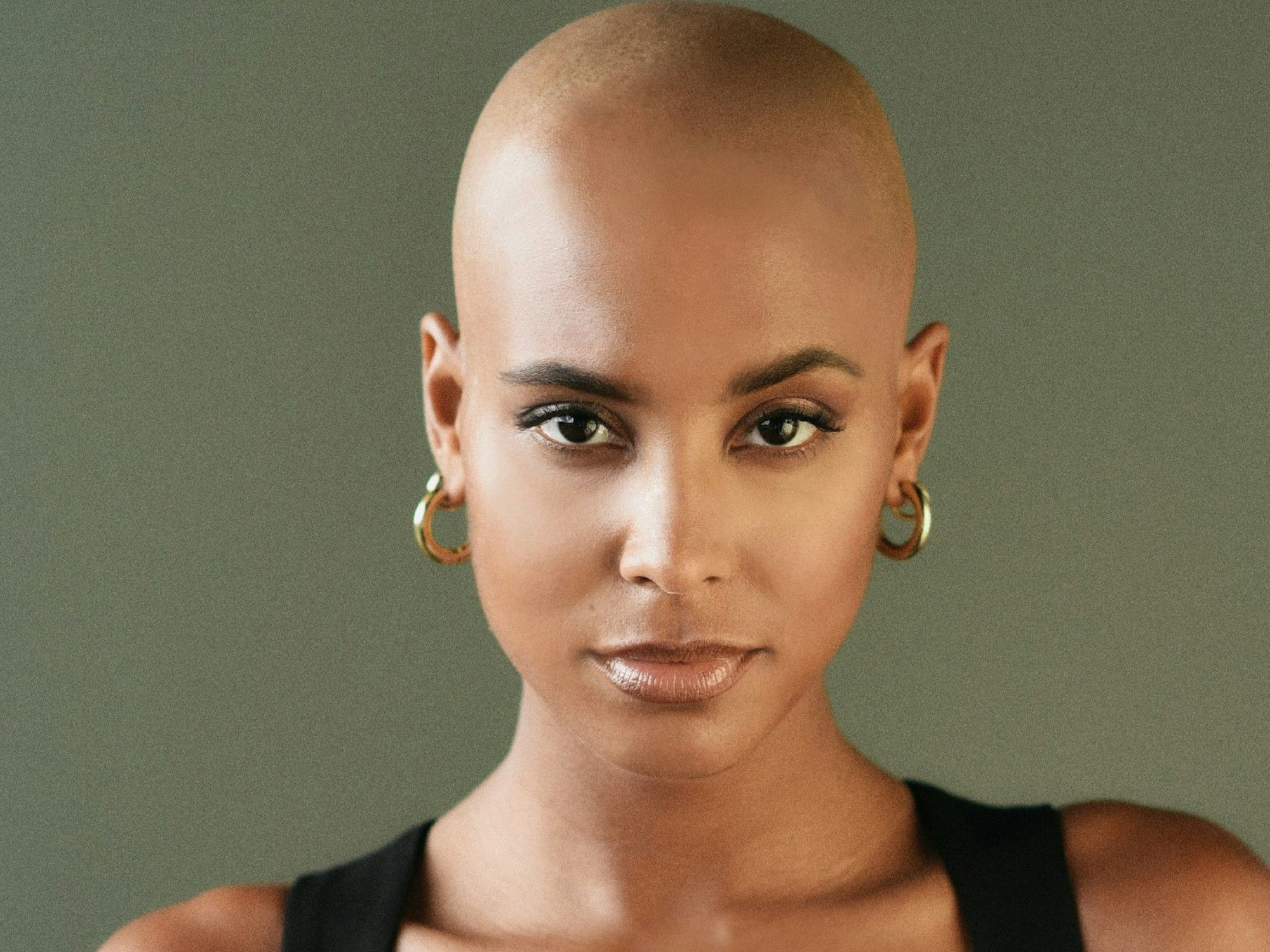 Sharon Battiste: Die RTL-Bachelorette leidet an kreisrundem Haarausfall. Vor der Show hat sie sich eine Glatz rasieren lassen.