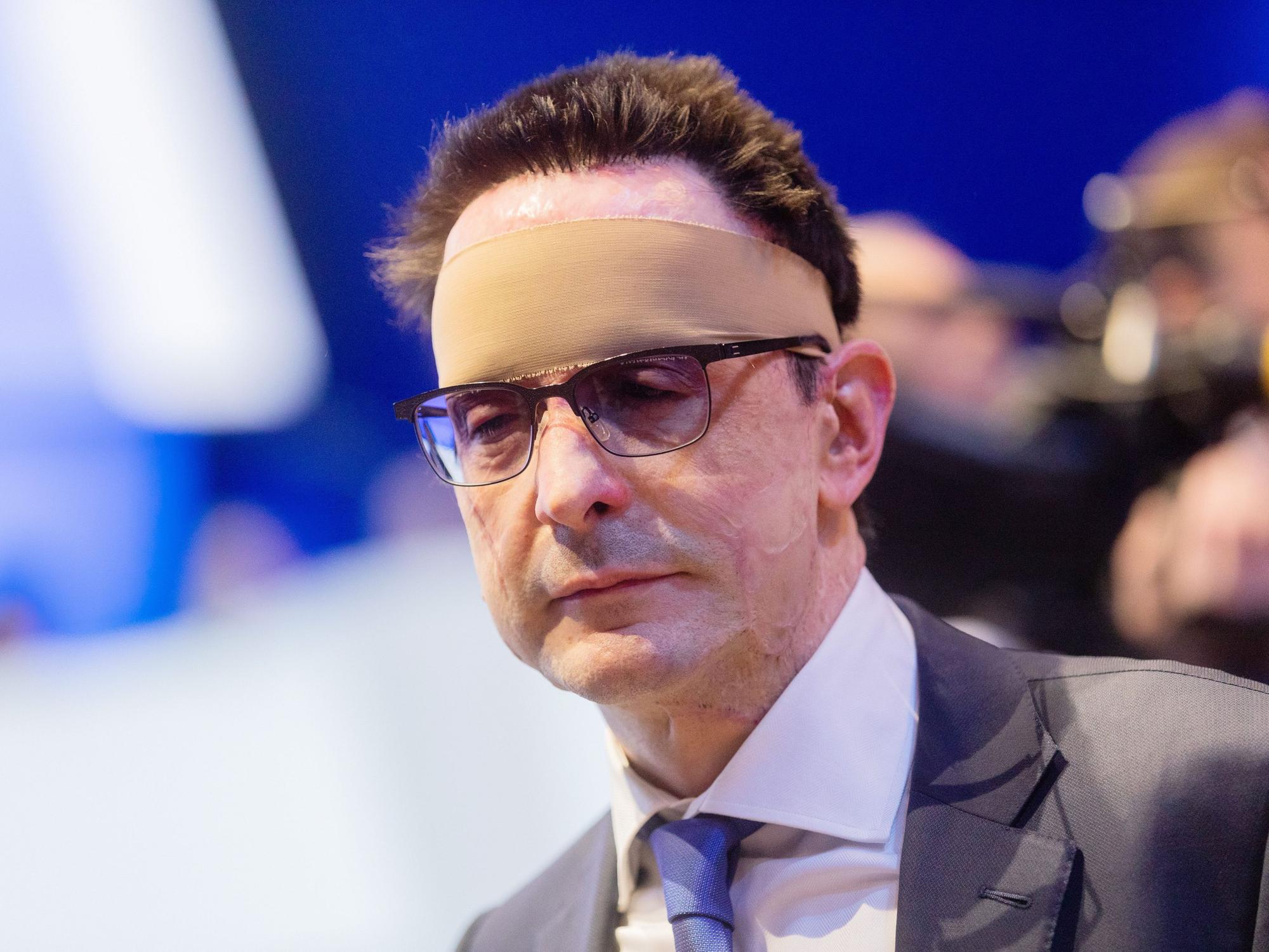 Bernhard Günther wurde bei dem Säure-Anschlag schwer verletzt. Unser Foto zeigt ihn 2020 mit einem Verband um den Kopf.