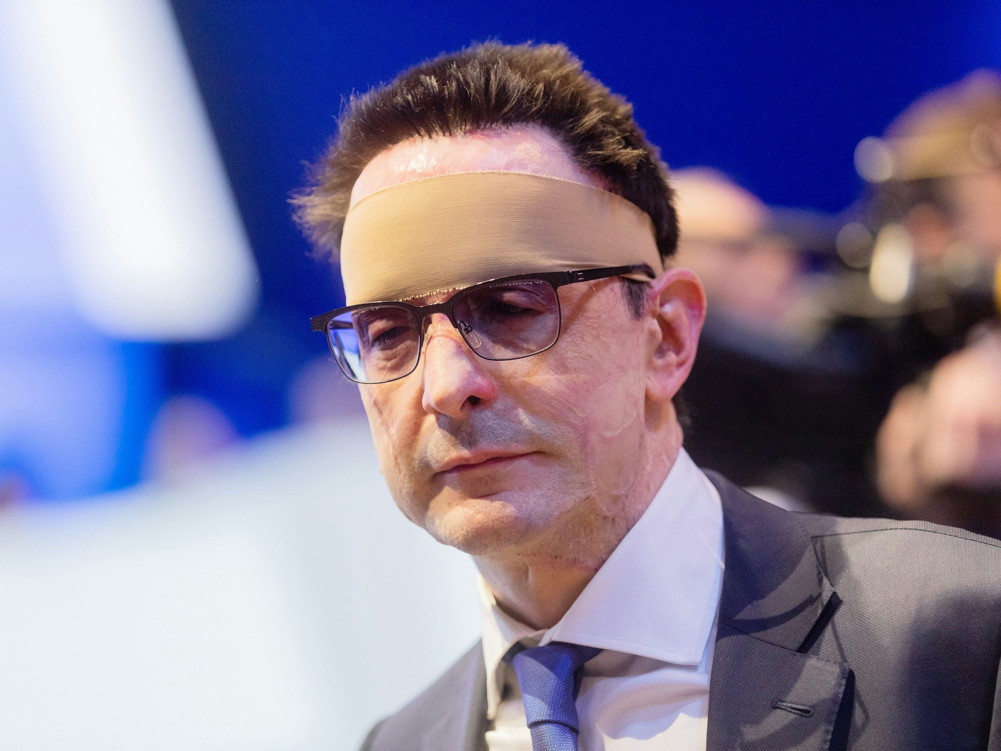 Bernhard Günther wurde bei dem Säure-Anschlag schwer verletzt. Unser Foto zeigt ihn 2020 mit einem Verband um den Kopf.