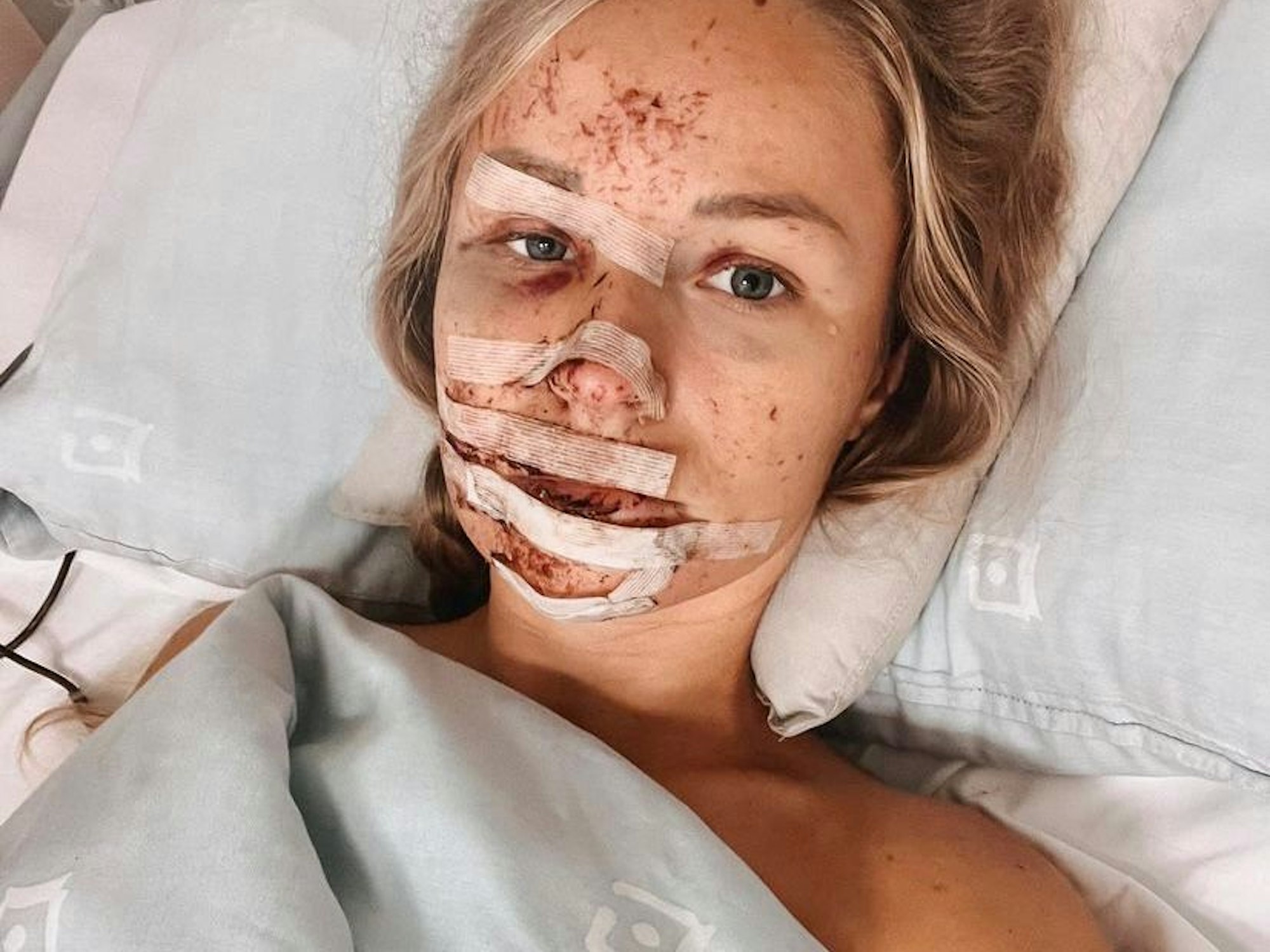 Jil Eileen liegt mit schweren Verletzungen im Krankenhaus.