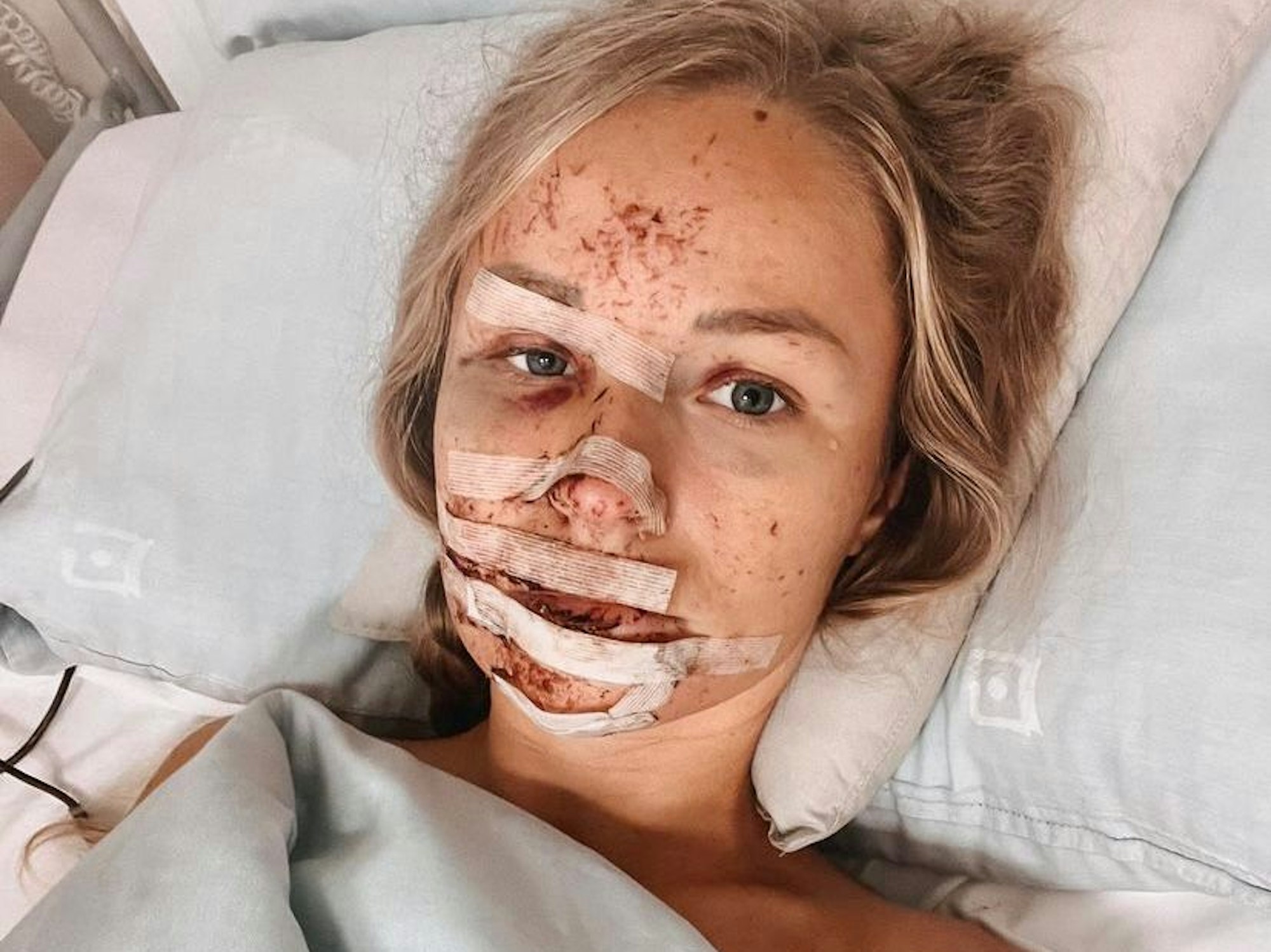 Jil Eileen liegt mit schweren Verletzungen im Krankenhaus.