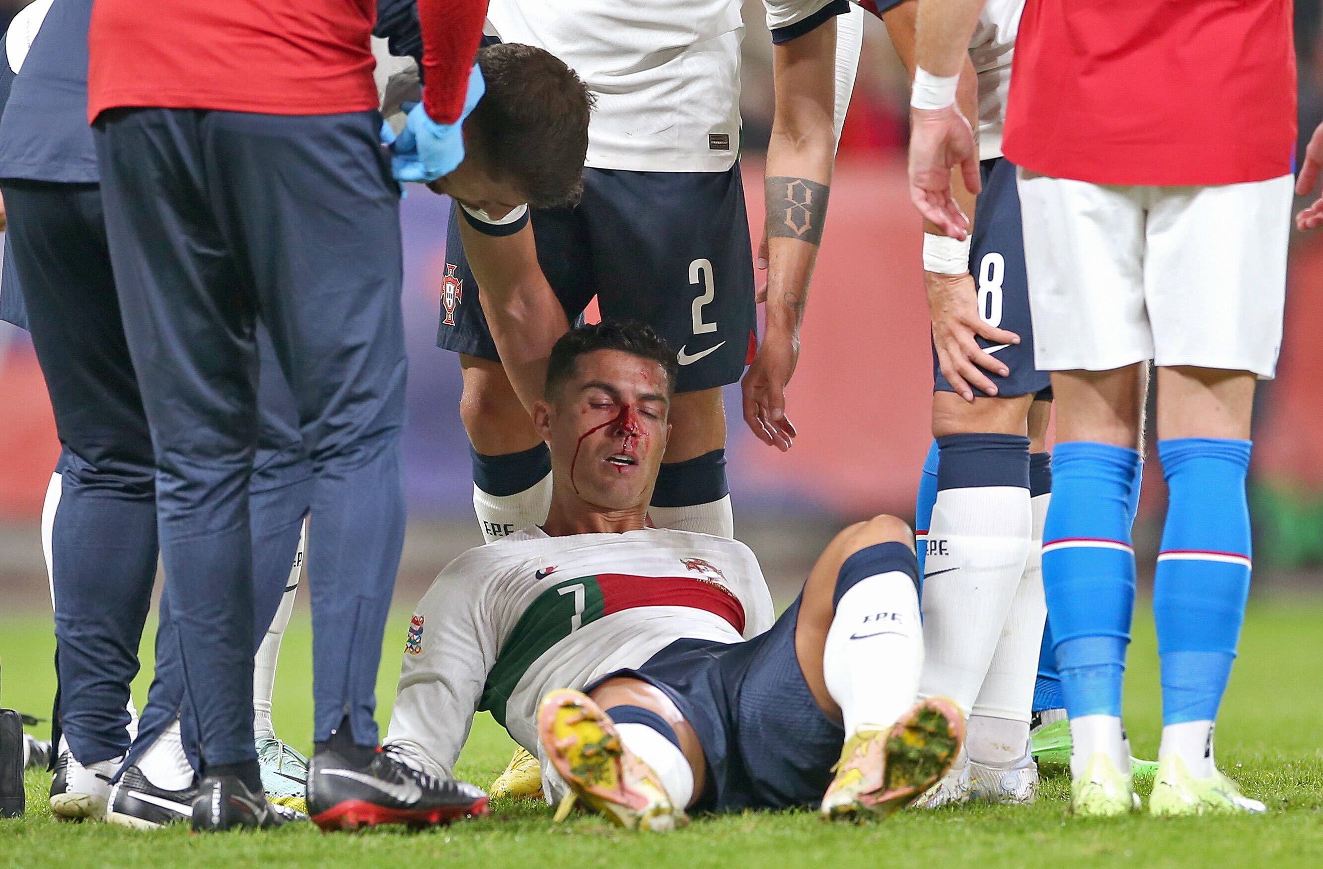 Cristiano Ronaldo Portugal verletzt nach Zusammenprall und muss behandelt werden.