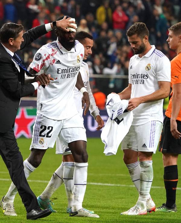 Antonio Rüdiger wird nach seiner Gesichtsverletzung blutend vom Platz gebracht.