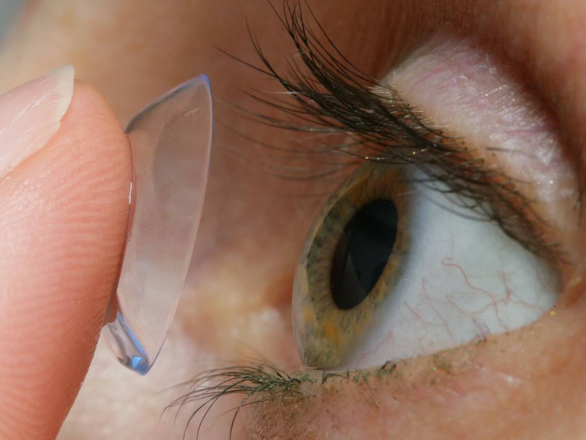 Eine Frau setzt sich eine Kontaktlinse auf das Auge.