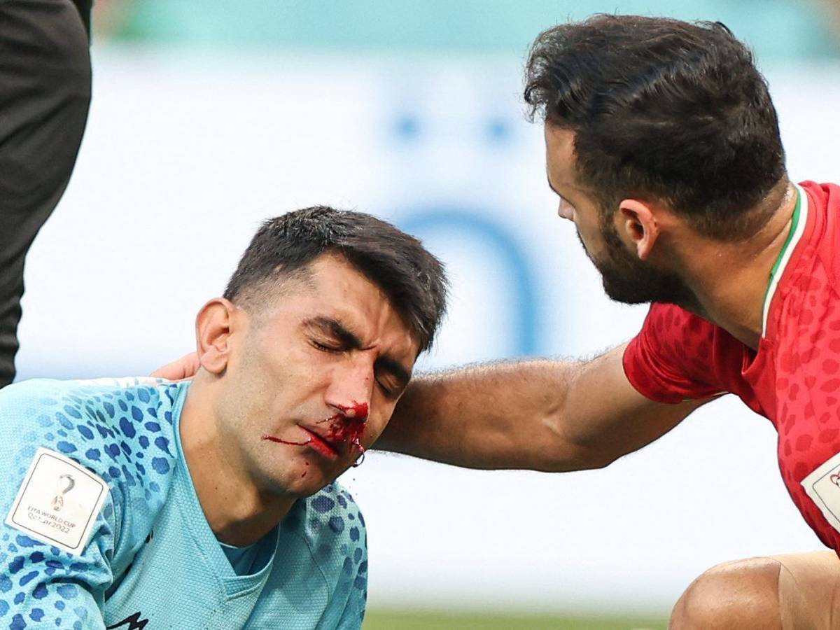 Irans Towrhüter Alireza Beiranvand nach dem Zusammenprall mit seinem Mitspieler Majid Hosseini im Spiel gegen England.