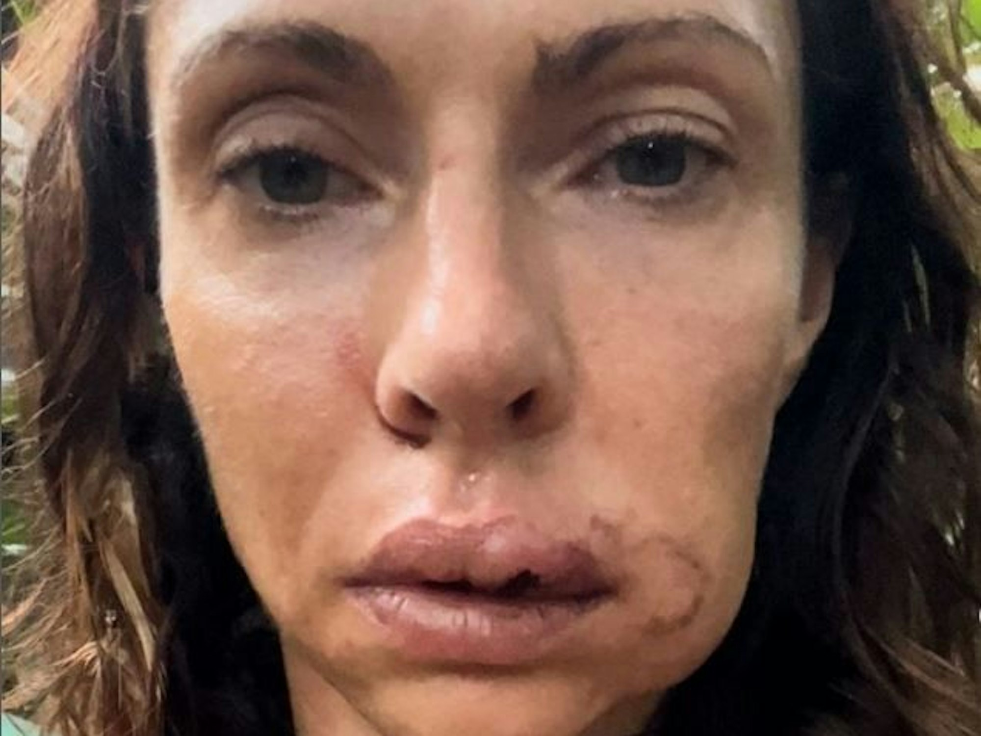 Schockierende Aufnahmen von Jana Pallaske zeigen die Dschungelcamp-Kandidatin 2023 mit Verletzungen.