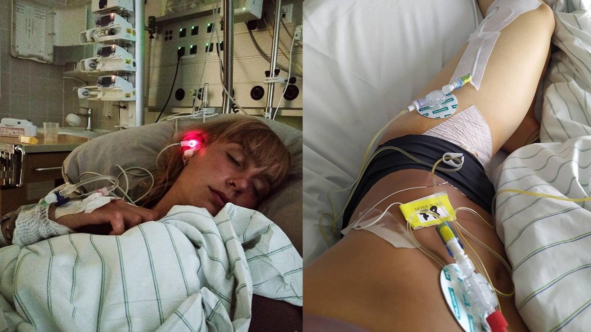 Elena (26) liegt im Krankenbett – sie leidet seit fünf Jahren an CRPS. Das rechte Foto zeigt ihr erkranktes linkes Bein.