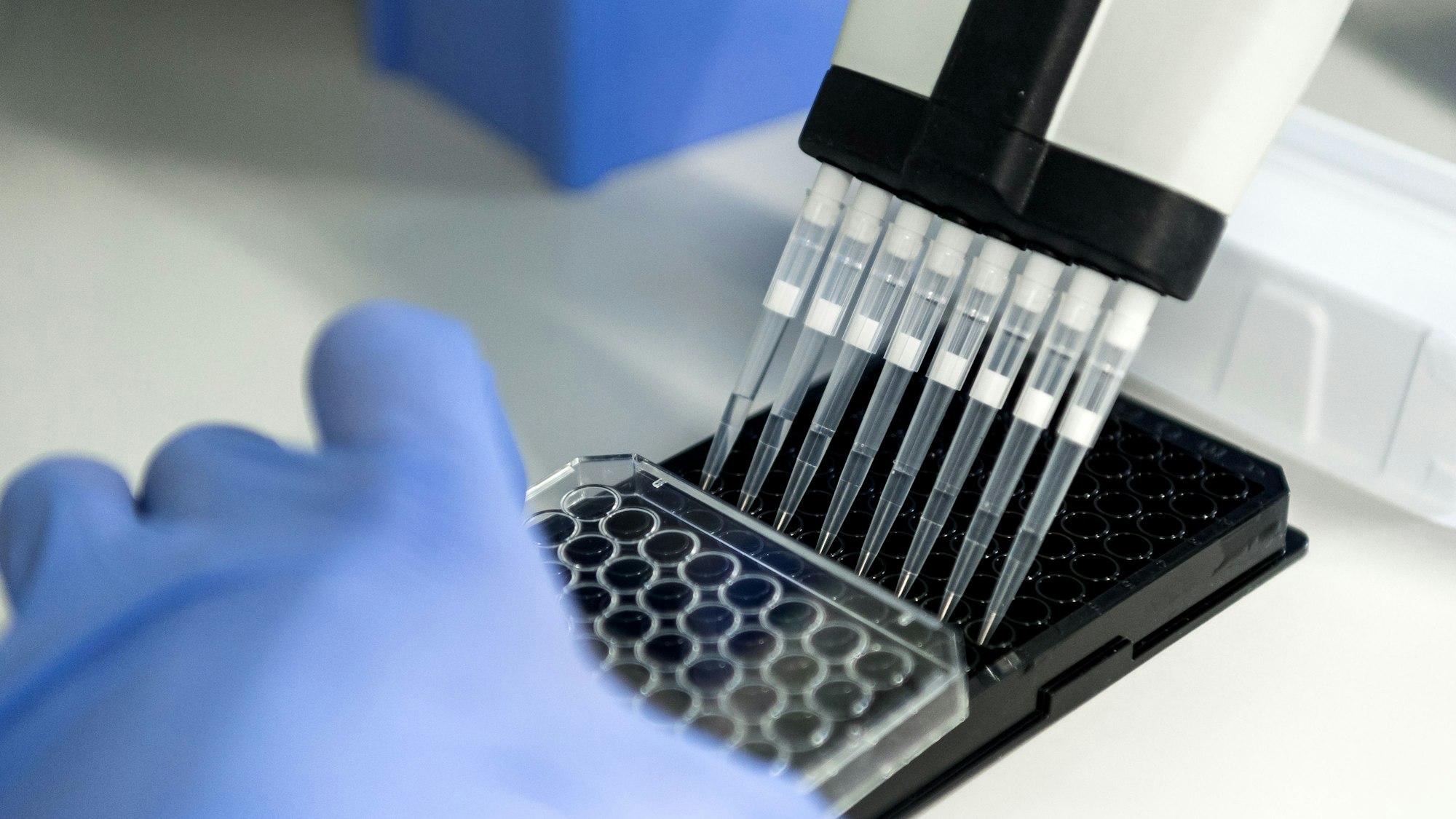 Das Symbolfoto aus dem Jahr 2019 zeigt eine Probenplatte, auf die mittels Pipetten eine Flüssigkeit gegeben wird. Die Platte wird von einer Hand in einem blauen Gummihandschuh festgehalten.