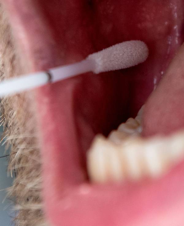 Das Symbolfoto aus dem Jahr 2019 zeigt einen Mann mit geöffnetem Mund und ein DNA-Teststäbchen, das Speichel an der Innenseite der Wange aufnimmt.