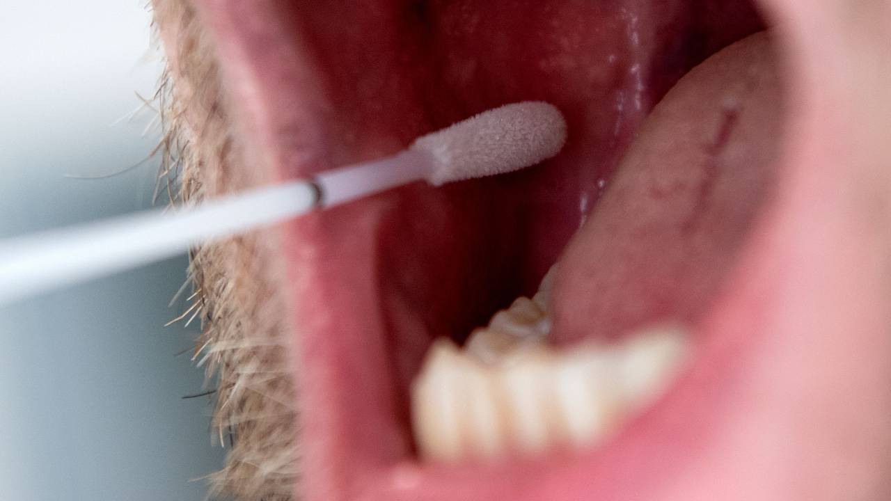 Das Symbolfoto aus dem Jahr 2019 zeigt einen Mann mit geöffnetem Mund und ein DNA-Teststäbchen, das Speichel an der Innenseite der Wange aufnimmt.