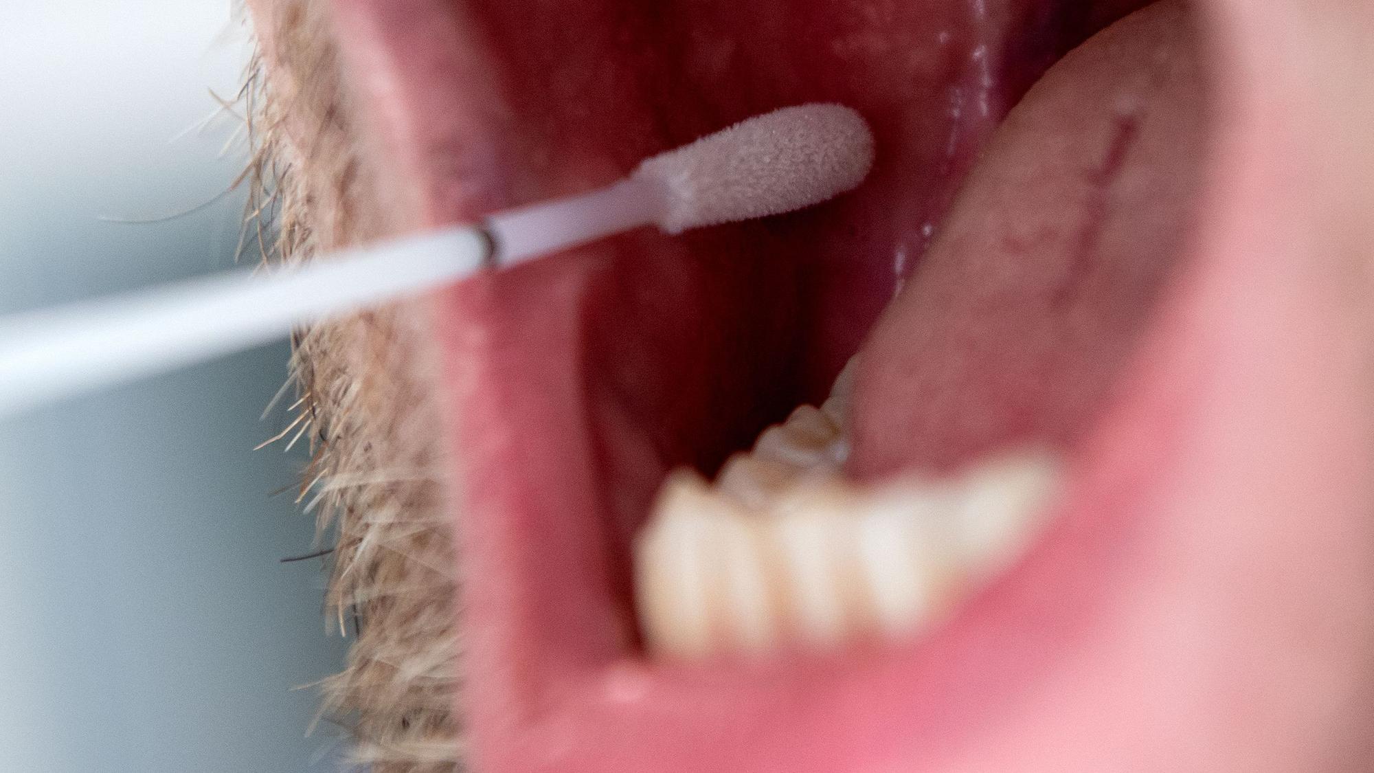 Das Symbolfoto aus dem Jahr 2019 zeigt einen Mann mit geöffnetem Mund und ein DNA-Teststäbchen, das Speichel an der Innenseite der Wange aufnimmt.