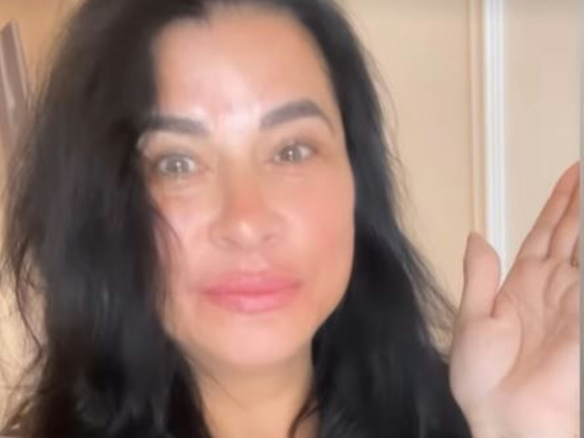 Auf Instagram präsentiert Iris Klein das Ergebnis ihrer Lippen-Auffüllung