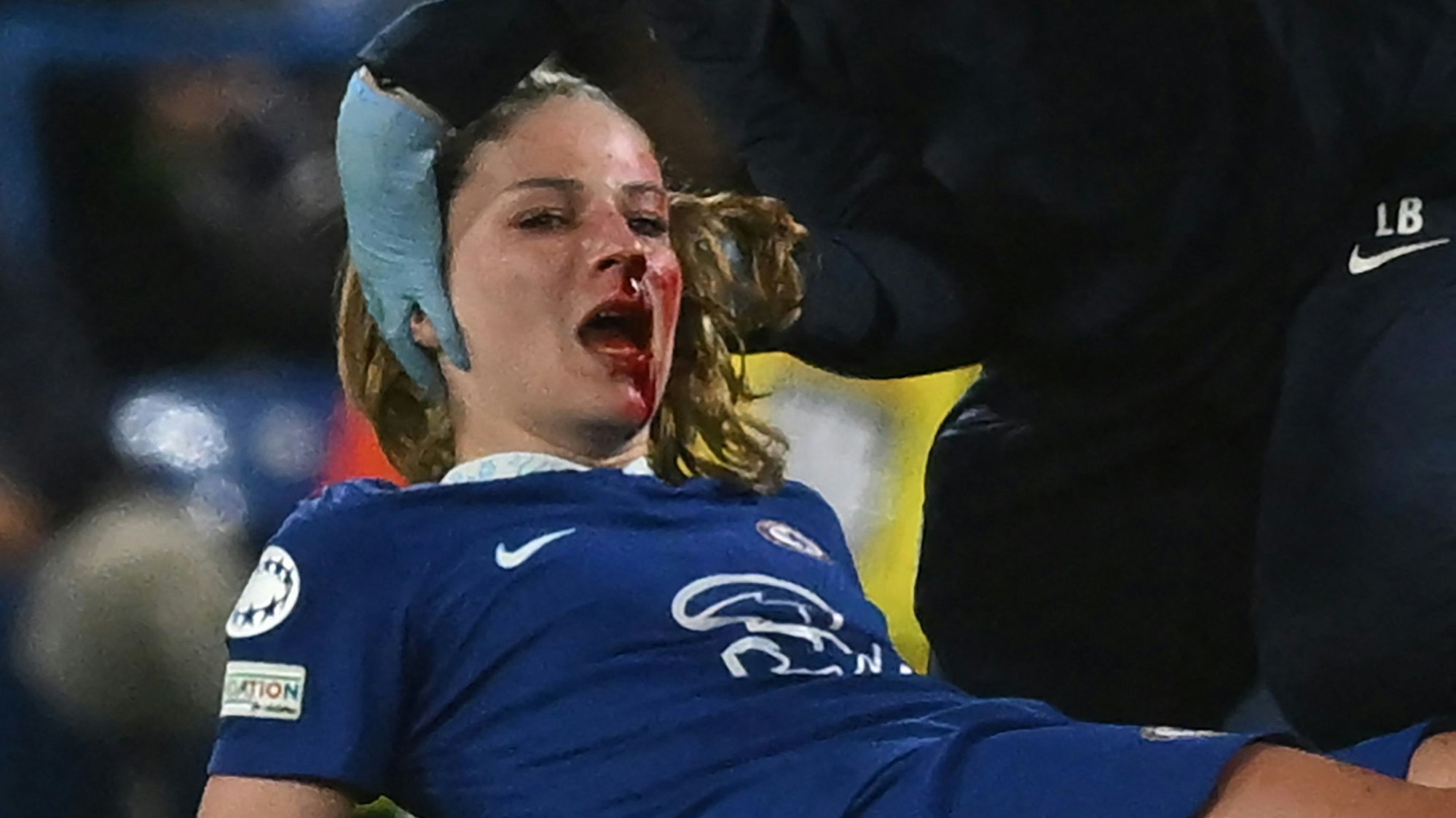 Melanie Leupolz wird nach einer Verletzung im Gesicht auf dem Platz behandelt.