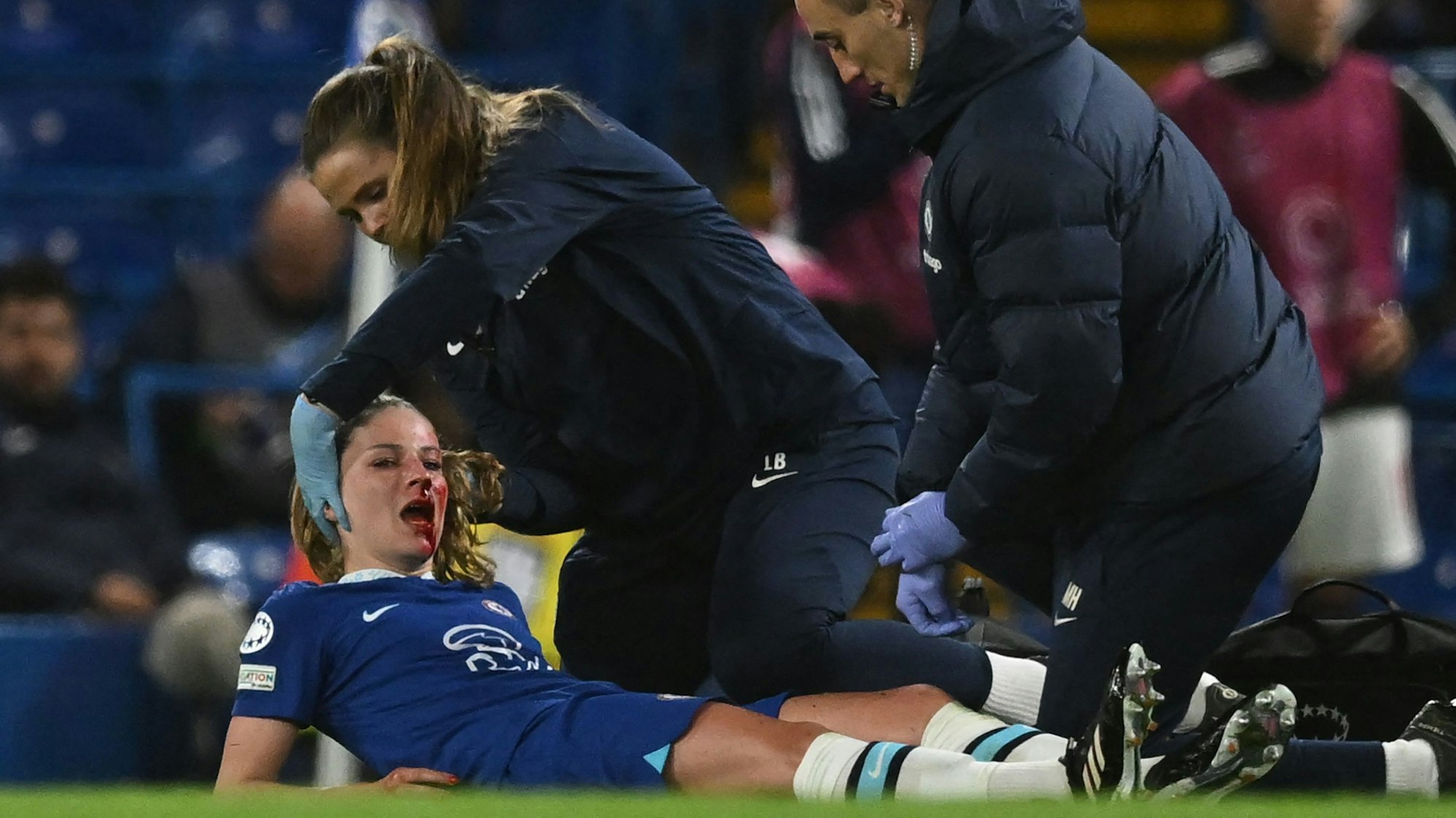 Melanie Leupolz wird behandelt, sie blutet heftig aus der Nase.