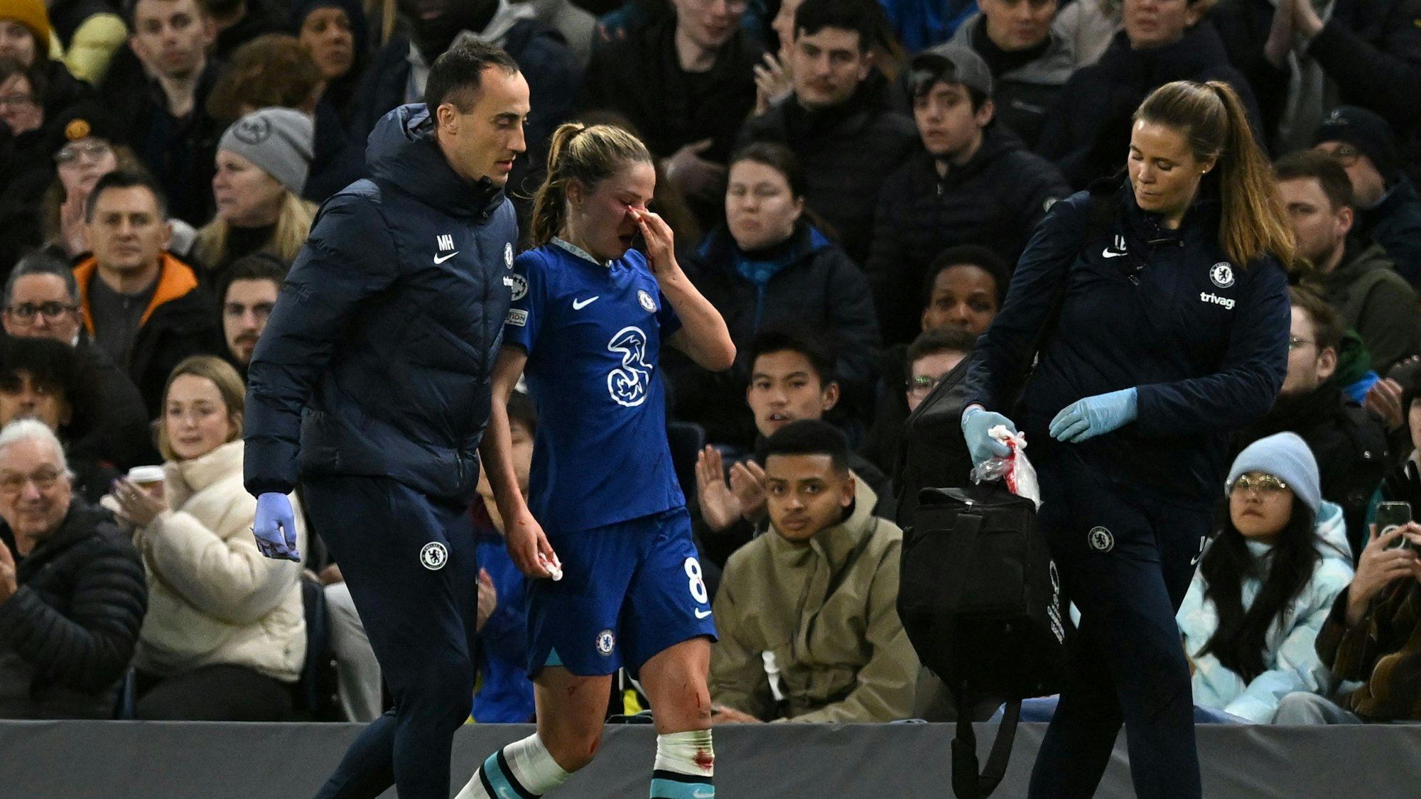Melanie Leupolz vom FC Chelsea geht im Spiel gegen Lyon blutend vom Feld. Sie hält sich die schmerzende Nase.