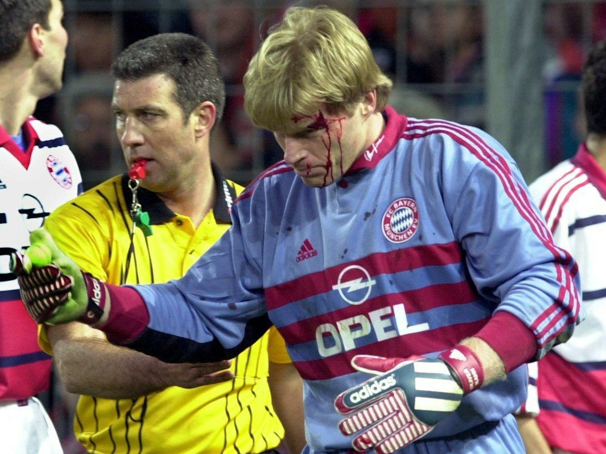 Schiedsrichter Uwe Kemmling und der mit Blut überströmte Bayern-Torhüter Oliver Kahn im Freiburger Dreisamstadion. Kahn hölt einen Golfball im rechten Handschuh.