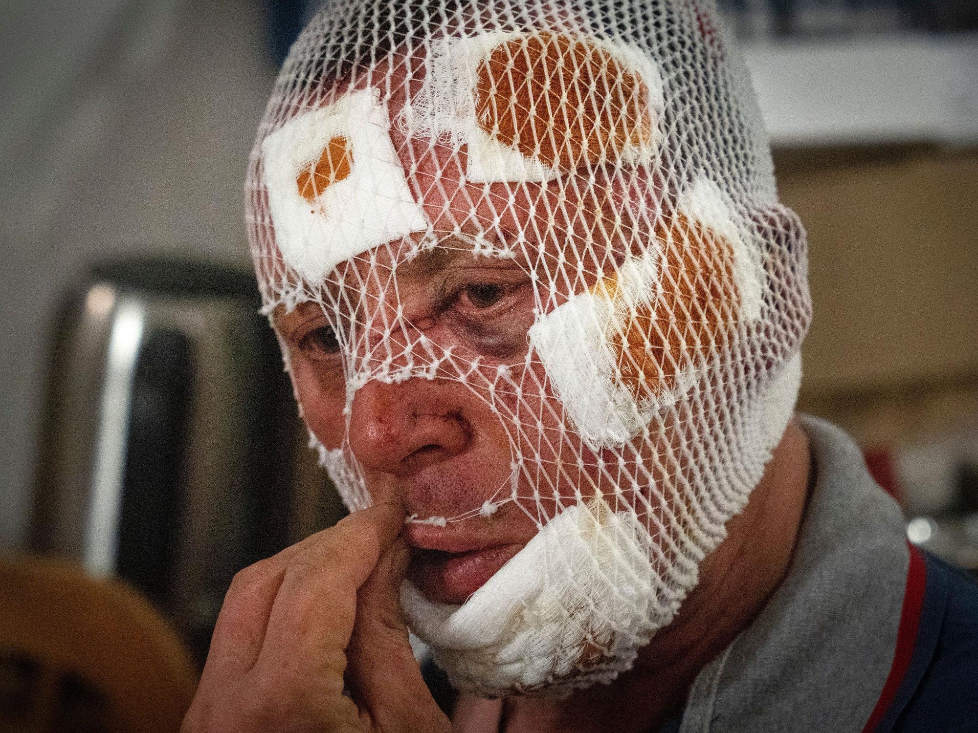 Ein verwundeter ukrainischer Soldat fasst sich am 24. Mai 2023 an einem medizinischen Stabilisierungspunkt in der Nähe von Bachmut (Ukraine) an den Mund.