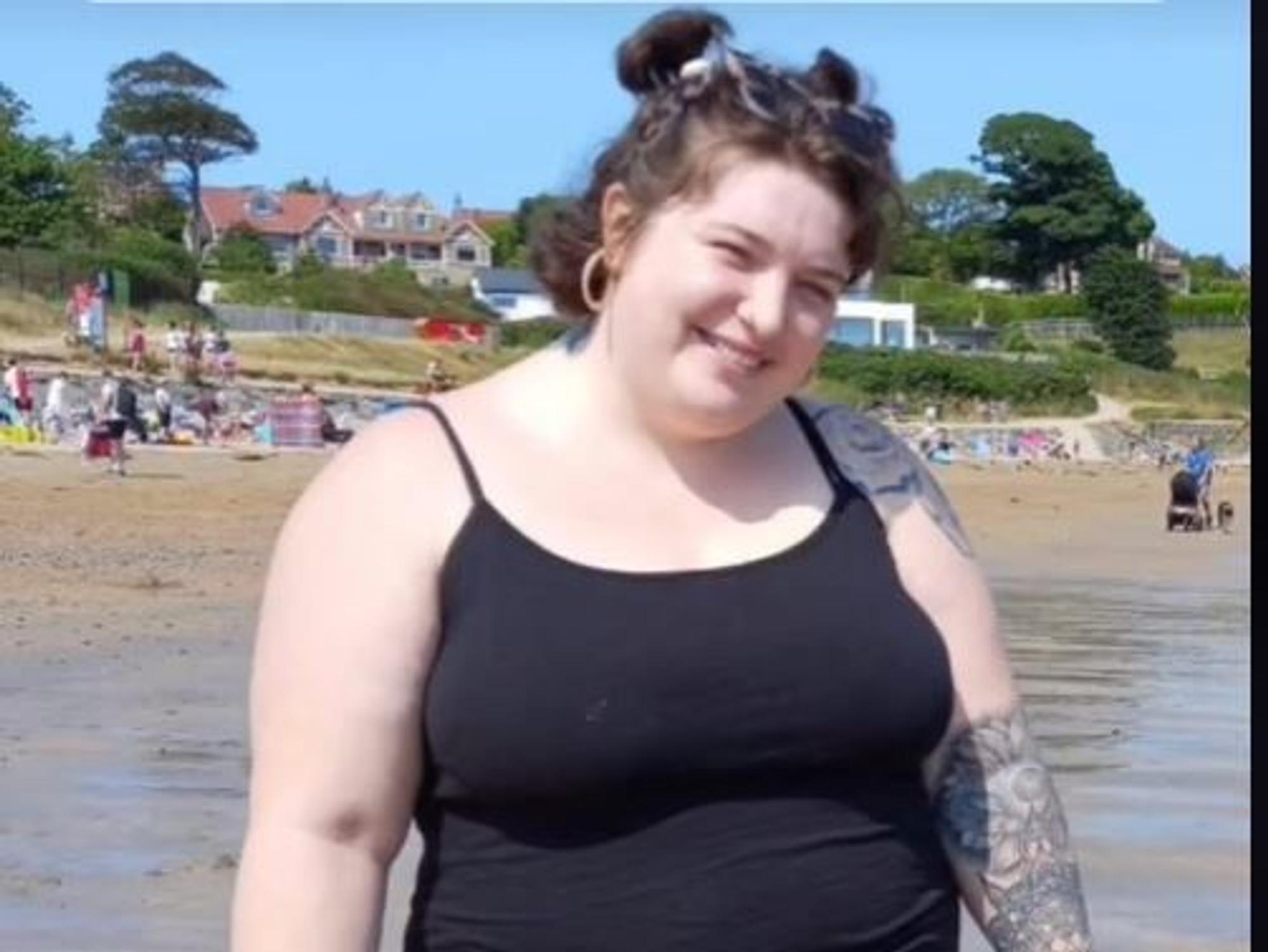 Caoimhe Whyte hat fast 50 Kilo abgenommen und ist heute kaum wiederzuerkennen.