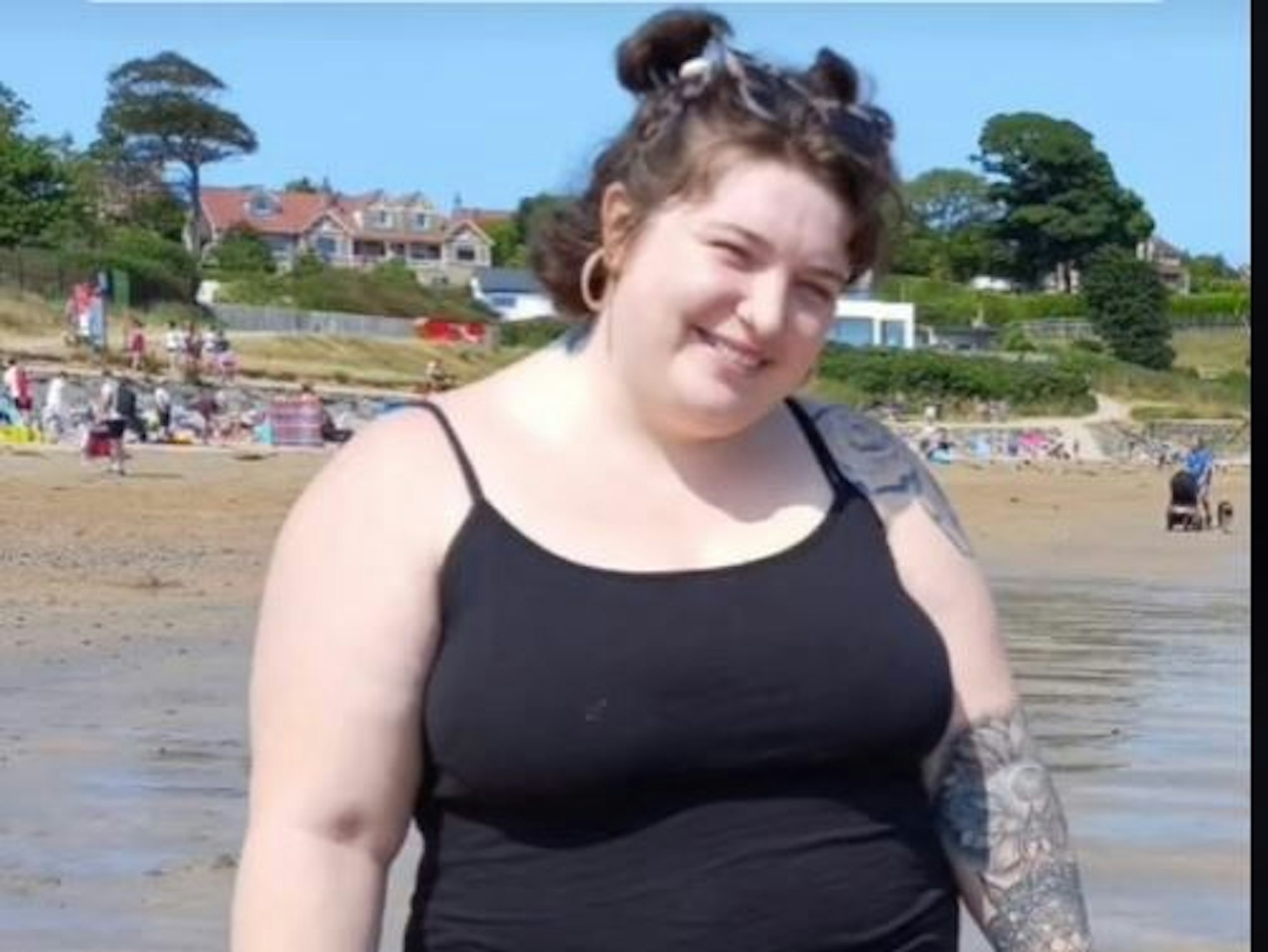 Caoimhe Whyte hat fast 50 Kilo abgenommen und ist heute kaum wiederzuerkennen.