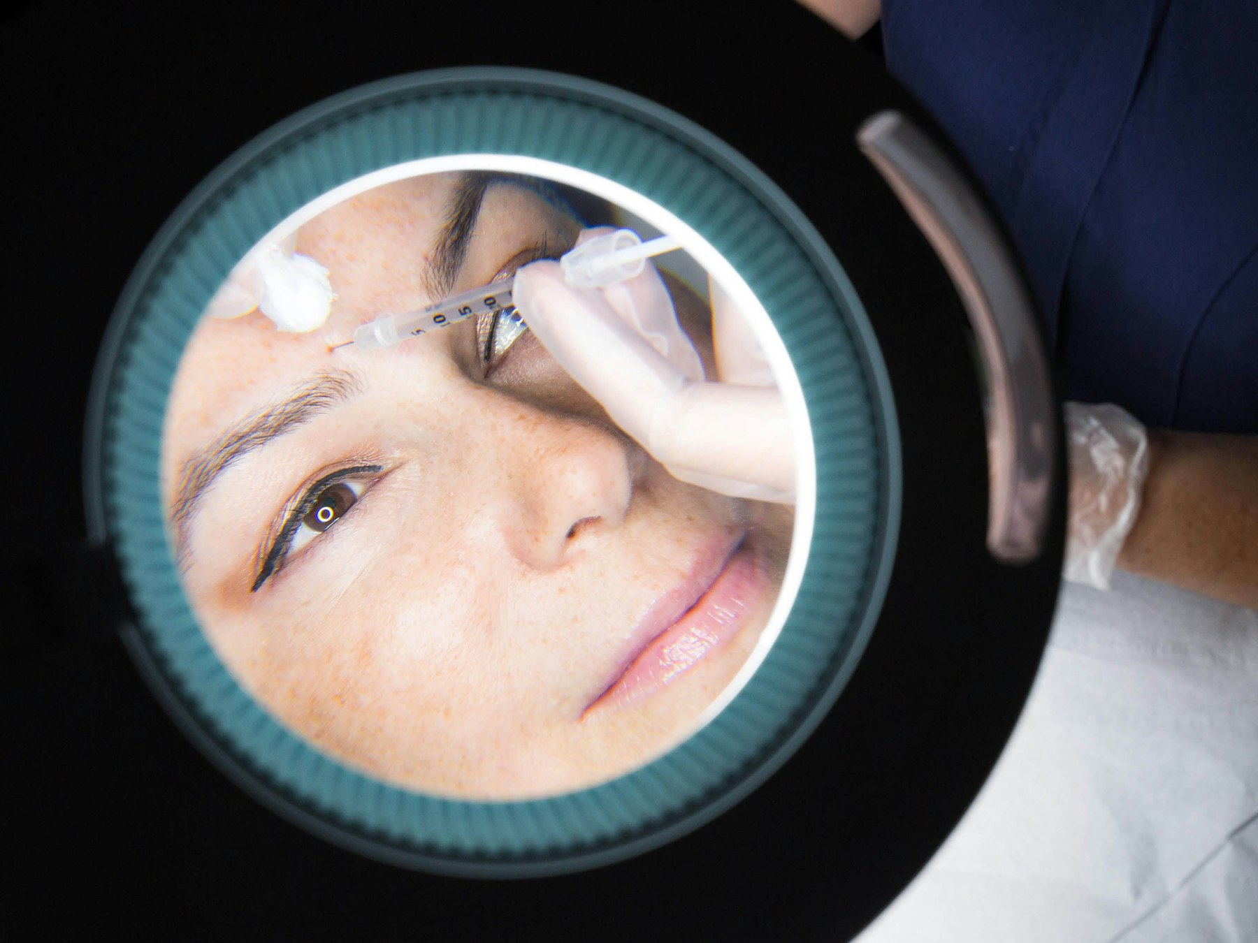 Eine Frau erhält eine Botox-Injektion.