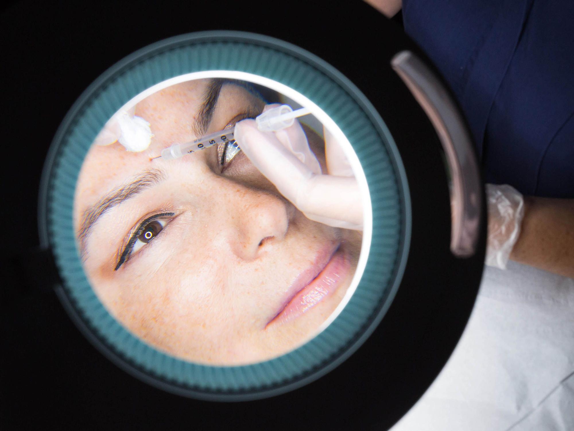 Eine Frau erhält eine Botox-Injektion.