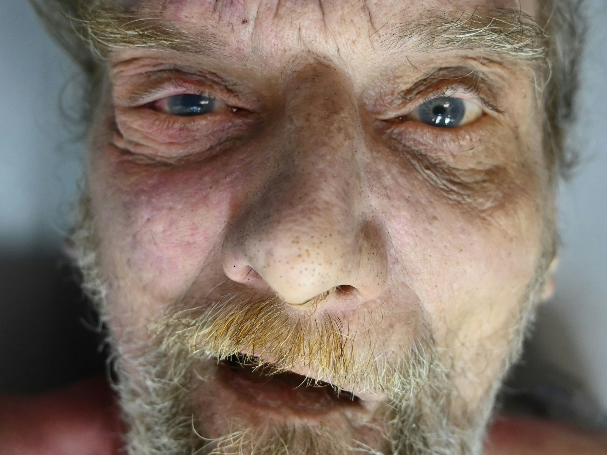 Ein Bild eines toten Mannes, der mit offenen Augen in die Kamera zu schauen scheint.