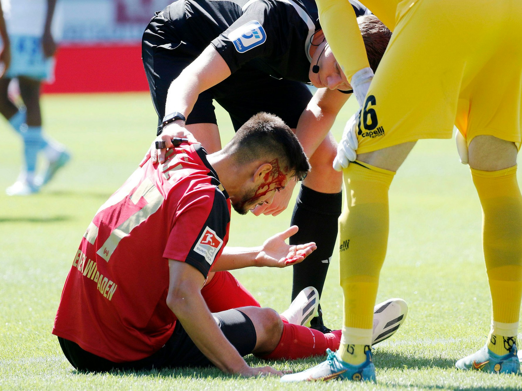 Wiesbaden-Profi Nico Rieble sitzt mit einer Platzwunde am Kopf auf dem Rasen.