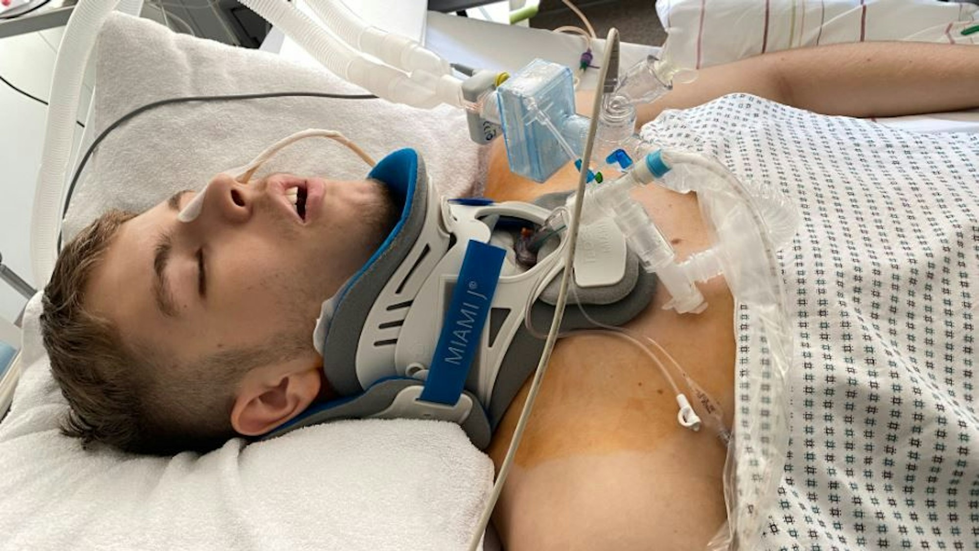 Junger Mann liegt mit Halskrause und an Geräte angeschlossen in einem Krankenbett.
