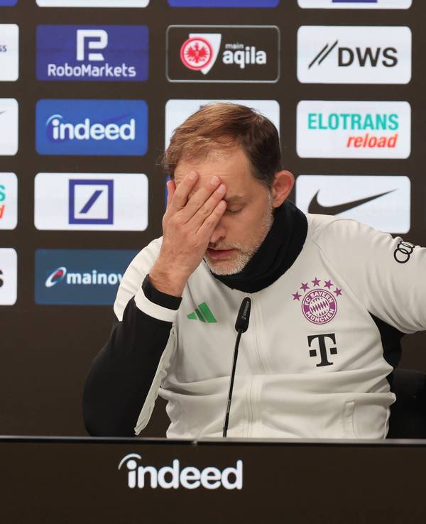 Thomas Tuchel fasst sich an die Stirn.