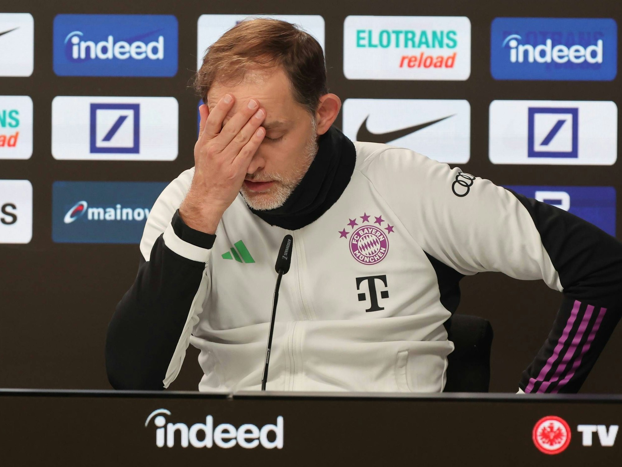 Thomas Tuchel fasst sich an die Stirn.