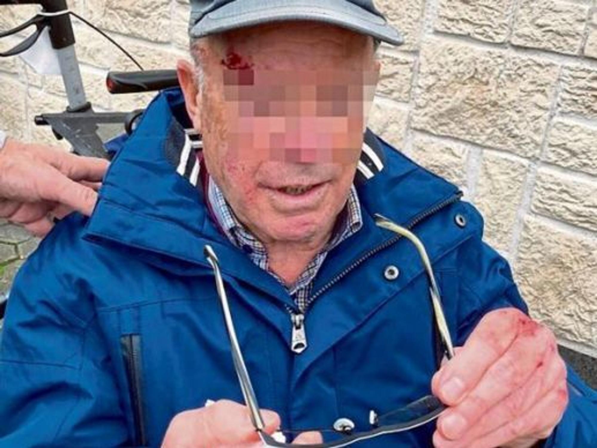 Ein 84-jähriger Mann war über die Stolperfalle in Köln-Sürth gefallen.