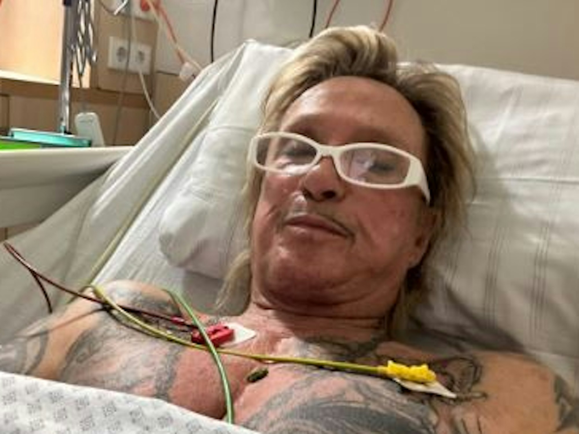 Bert Wollersheim nach OP an Halsschlagader