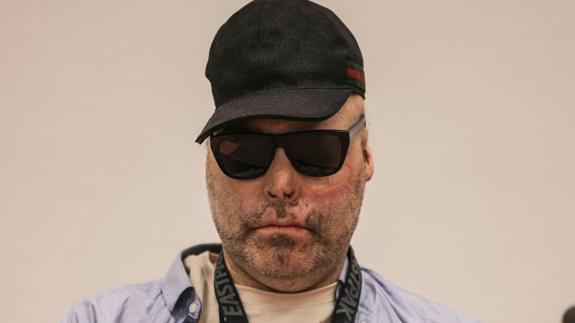 Der Angeklagte tragt eine Basecap und eine Sonnenbrille, sein Gesicht ist von Brandnarben gezeichnet.