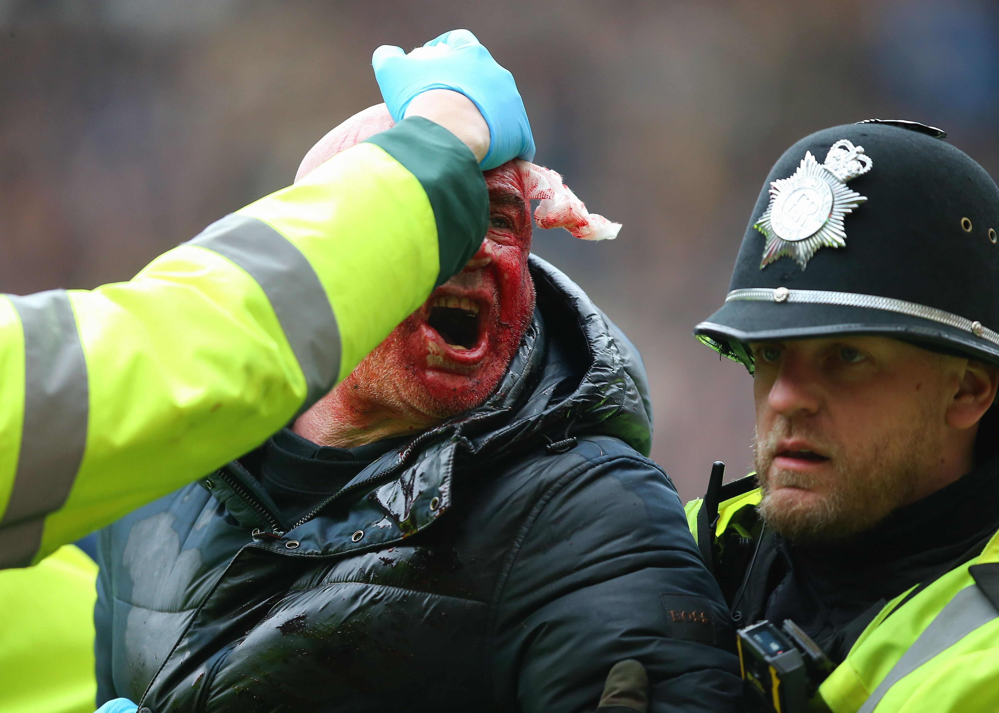Während des Spiels wird ein Fan von der Polizei aus dem Stadion gebracht, während er wegen einer Kopfwunde behandelt wird.